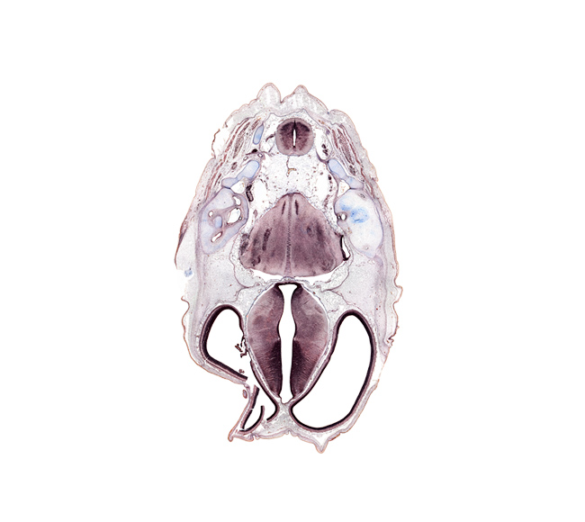 C-1 spinal ganglion, anterior semicircular duct, artifact(s), cephalic edge of auricle, cerebral vesicle (telencephalon), fasciculus cuneatus, fasciculus gracilis, glossopharyngeal nerve (CN IX), insula of cerebral hemisphere, jugular foramen, medial accessory olivary nucleus, nucleus of spinal tract of trigeminal nerve, posterior arch of C-1 vertebra (atlas), posterior semicircular duct, root of vagus nerve (CN X), spinal tract of trigeminal nerve (CN V), subarachnoid space, suboccipital nerve (C-I), tract of abducens nerve (CN VI), utricle