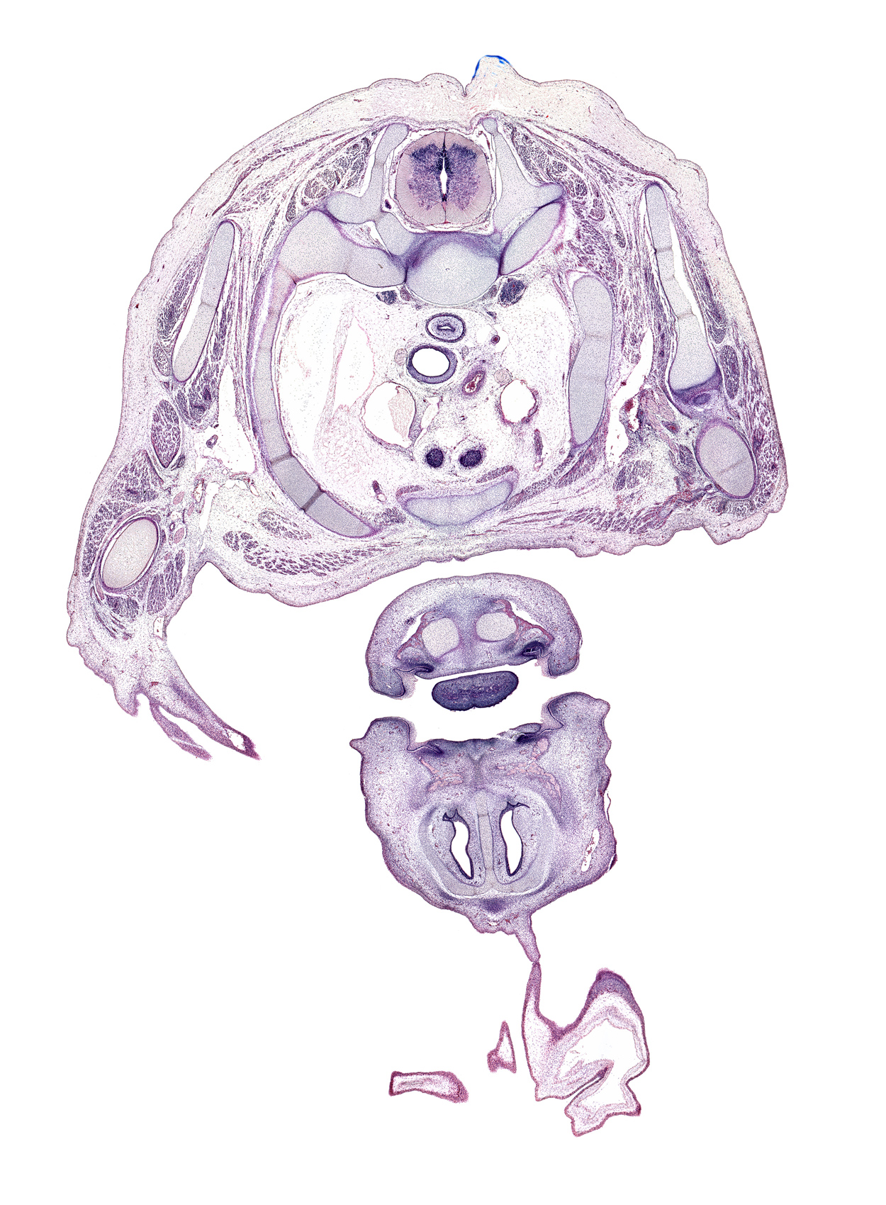 T-1 / T-2 interganglion region, T-1 / T-2 intervertebral disc, arch of aorta, biceps brachii muscle, body of tongue, brachialis muscle, cephalic edge of right pleural cavity, dorsal horn of grey matter, frontal prominence, head of rib 2, humerus, interorbital ligament, lateral horn of grey matter, left subclavian artery, lower lip, nasal capsule cartilage, nasal cavity (nasal sac), nasal septal cartilage, neural arch of T-1 vertebra, oral cavity, pharyngeal arch 1 cartilage (Meckel), primary palate, radial nerve, rib 1, right lobe of thymus gland, scapula, serratus anterior muscle, subscapularis muscle, superior vena cava, surface ectoderm, sympathetic trunk, transverse process of T-1 vertebra, upper lip, ventral horn of grey matter