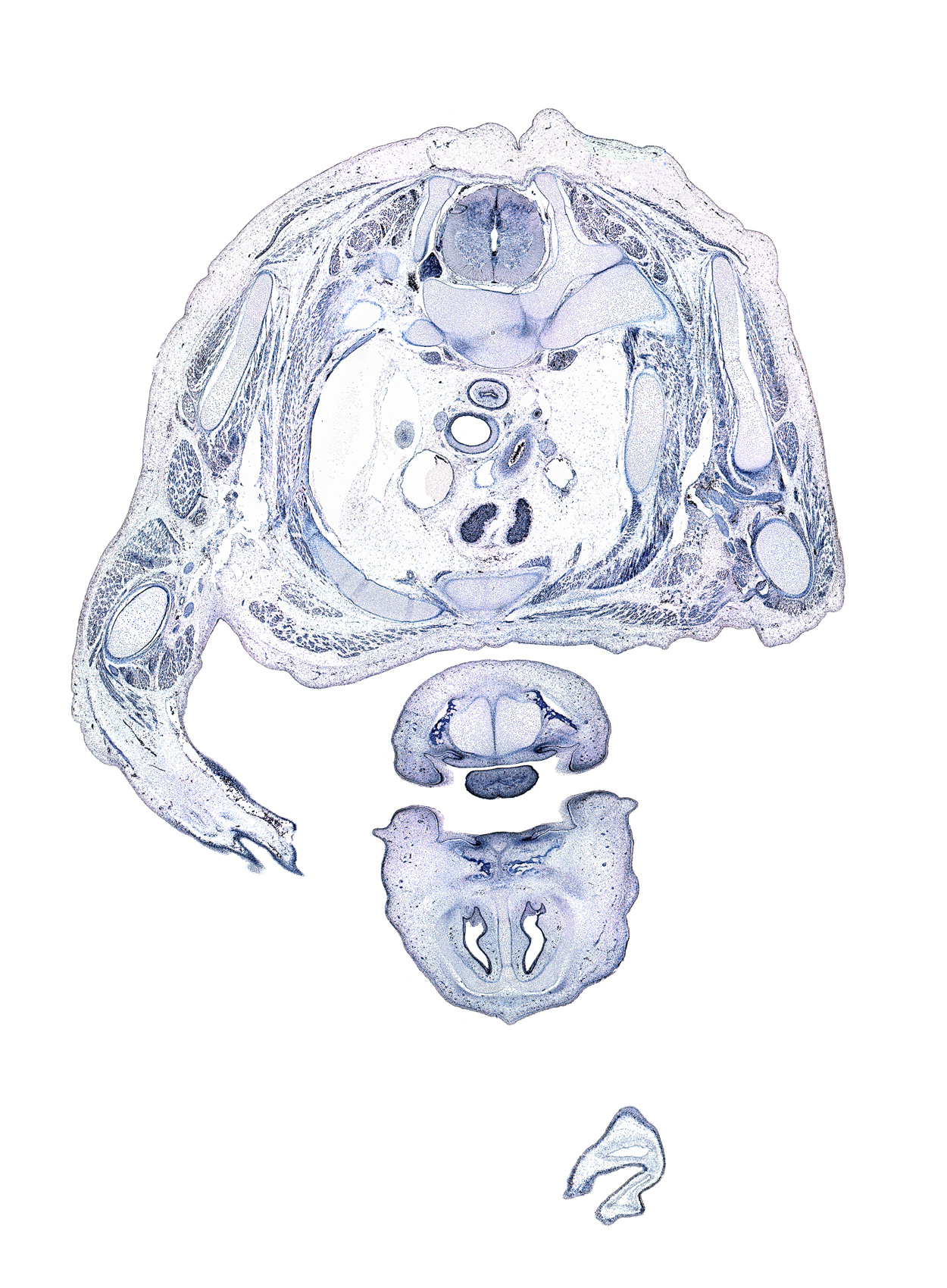 T-1 / T-2 interganglion region, arch of aorta, cephalic edge of right lung, dorsal horn of grey matter, edge of frontal prominence, humerus, junction of pharyngeal arch 1 cartilages (Meckel), lateral horn of grey matter, latissimus dorsi muscle, left lobe of thymus gland, left subclavian artery, loose mesenchyme, nasal cavity (nasal sac), oral cavity, phrenic nerve, pleural cavity, primary palate, radial nerve, rhomboid major muscle, rib 2, superior vena cava, teres major muscle, tip of tongue, ventral horn of grey matter