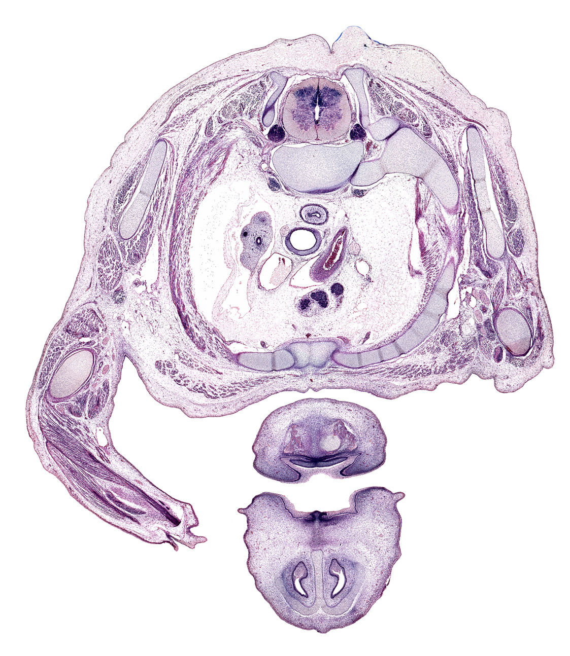 T-2 spinal ganglion, apex of right lung, arch of aorta, brachial artery, brachioradialis muscle, cephalic edge of pericardial cavity, chin, dura mater, esophagus, head of rib 2, left lobe of thymus gland, left recurrent laryngeal nerve, lower lip, nasal capsule cartilage, nasal cavity (nasal sac), nasal septal cartilage, neural arch, oral cavity, oral fissure, osteogenic layer, primary palate, rib 2, right vagus nerve (CN X), sympathetic trunk, tracheal lumen, vagus nerve (CN X)