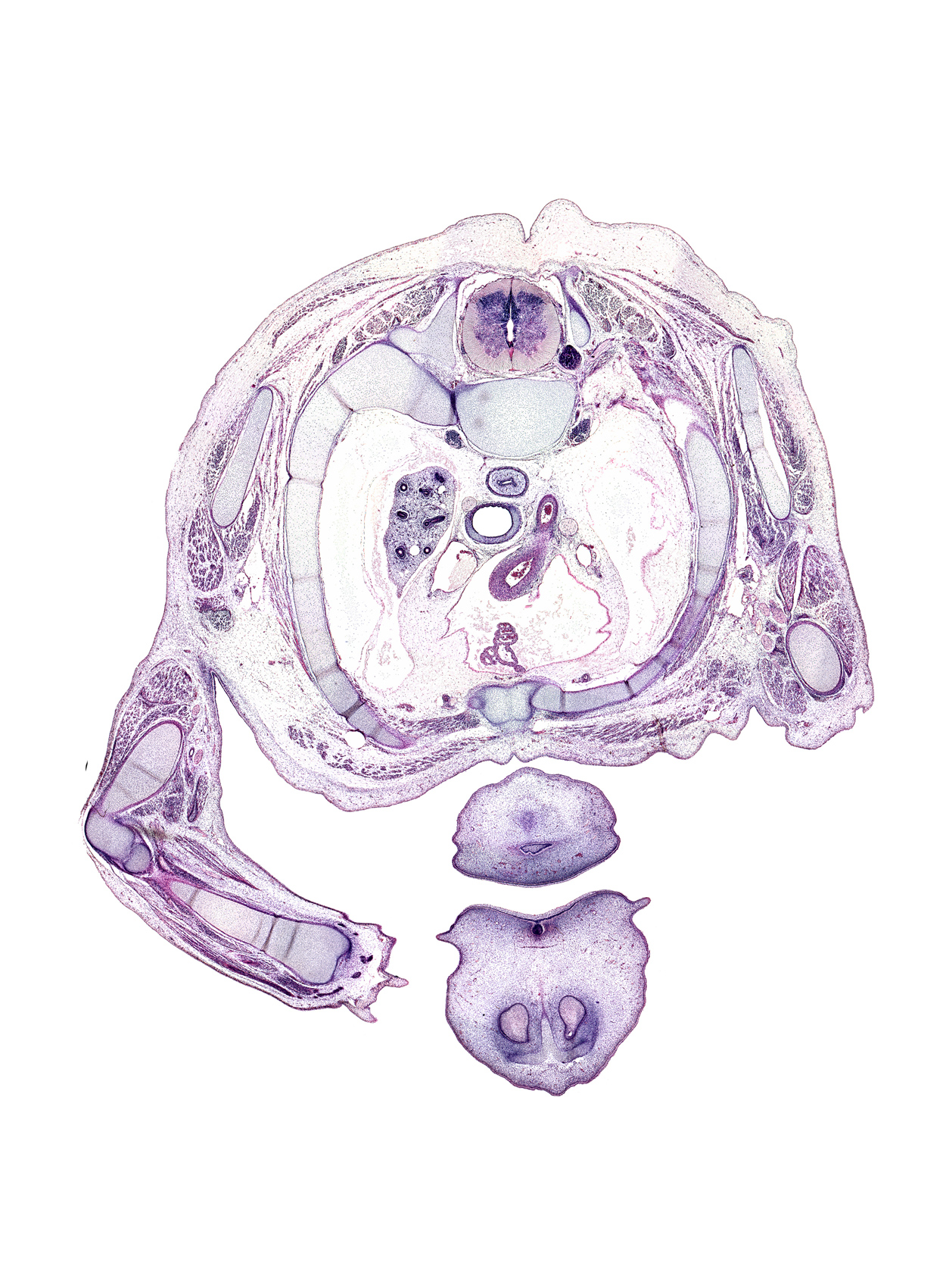 T-2 spinal ganglion, aorta, ascending aorta, brachialis muscle, cephalic edge of left pleural cavity, cephalic edge of right atrium, chin, epithelial plug in naris, extensor digitorum communis tendon, left vagus nerve (CN X), medial head of triceps brachii muscle, median nerve, pericardial cavity, primary palate, pulmogenic mesenchyme, radius, rib 2, sternal angle region, sympathetic trunk, ulnar nerve