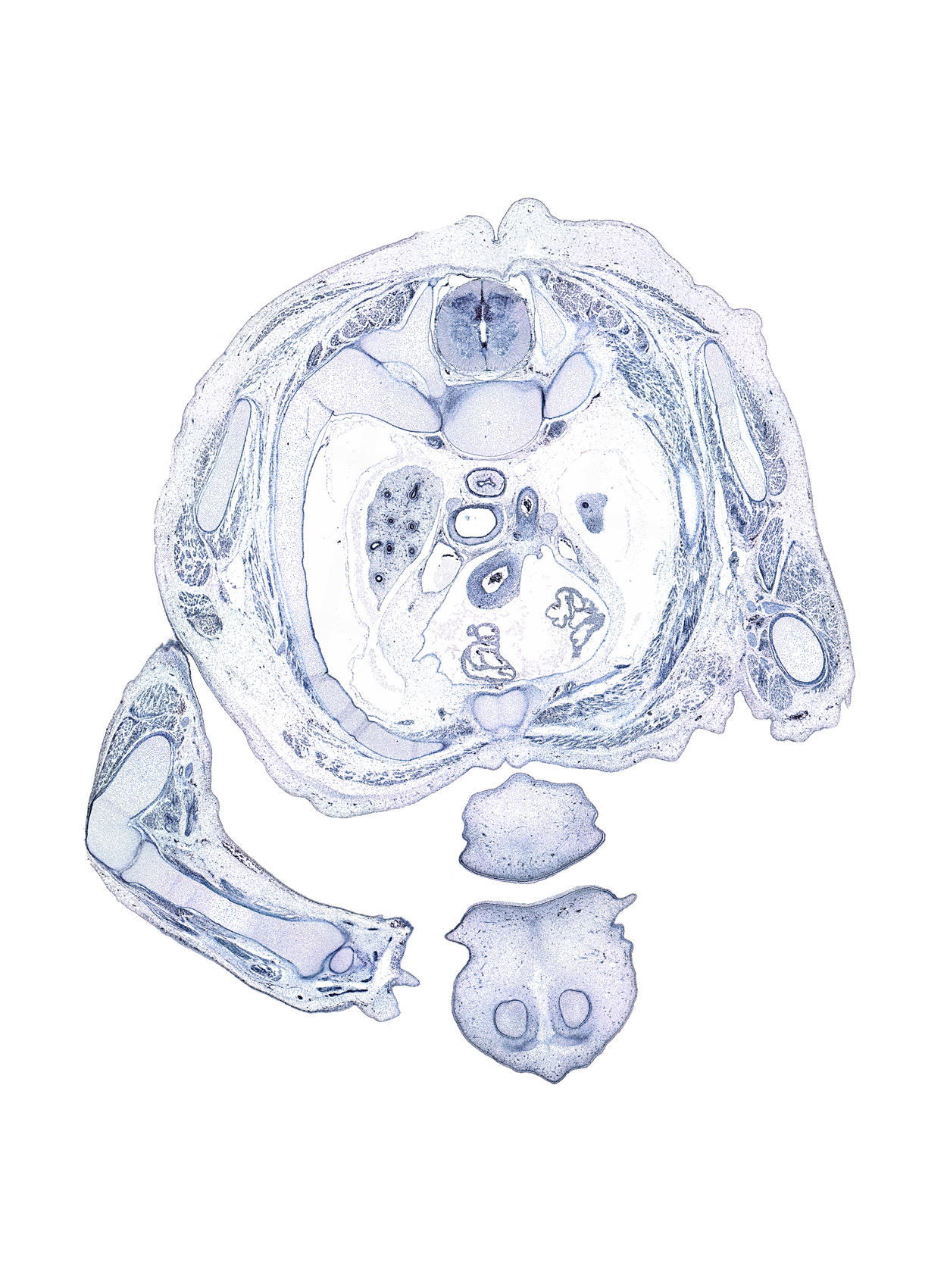 T-2 / T-3 interganglion region, apex of left lung, biceps brachii tendon, brachial artery, cephalic vein, dorsal horn of grey matter, epithelial plug, esophagus, head of radius, humerus, lateral head of triceps brachii muscle, latissimus dorsi muscle, left atrium, long head of triceps brachii muscle, middle part of upper lip, nose, oral cavity, phrenic nerve, rhomboid major muscle, right atrium, scaphoid, styloid process of radius, sympathetic trunk, teres major muscle, trachea, trapezius muscle, ventral horn of grey matter