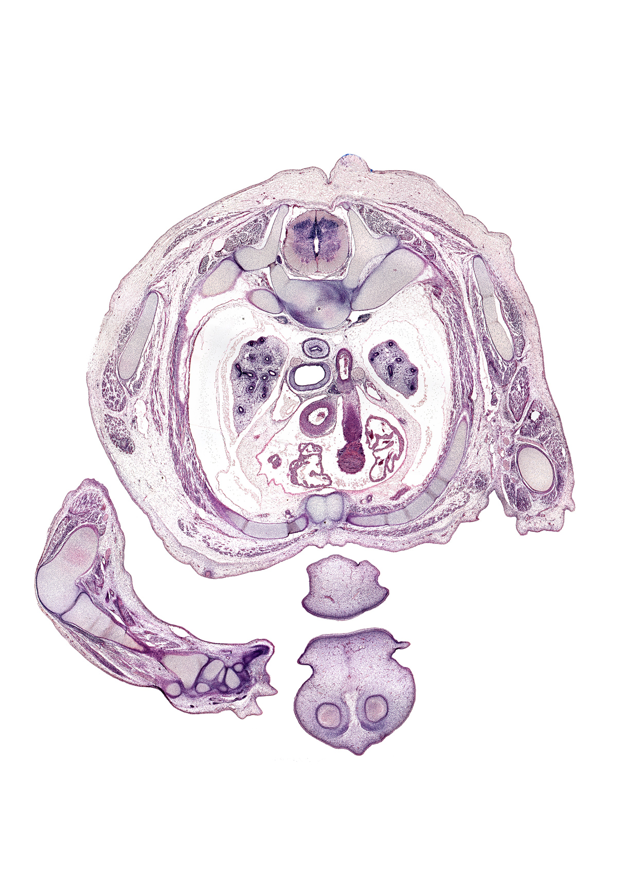 T-2 / T-3 interganglion region, T-2 / T-3 intervertebral disc, T-2 intercostal nerve, aorta, ascending aorta, chin, distal radio-ulnar joint, ductus arteriosus, epithelial plug in naris, esophagus, left atrium, lunate, mammary gland, median nerve, primary palate, pulmonary trunk, radius, rib 3, right atrium, scaphoid, trachea, tubercle of rib 3, ulna, ulnar nerve, upper lip, upper lobe of left lung