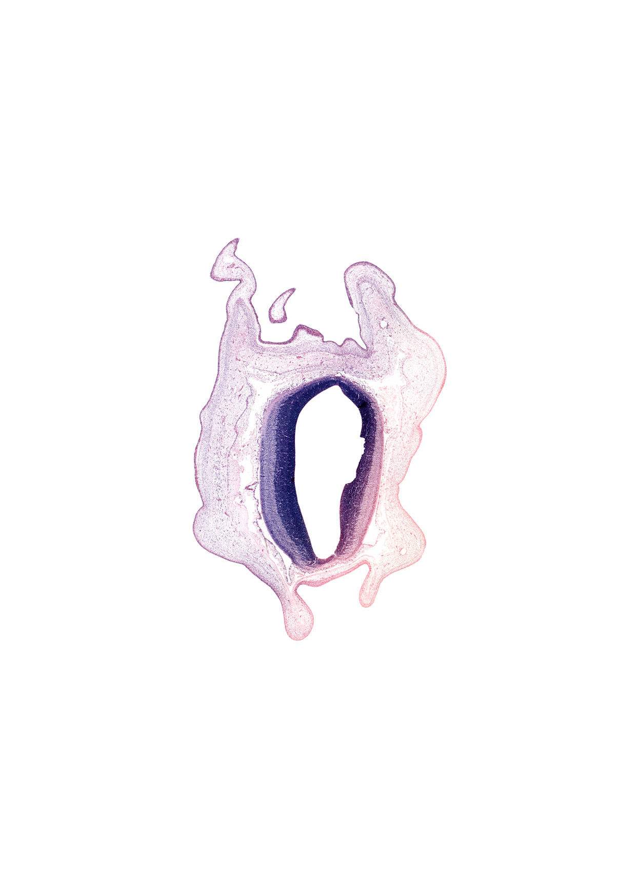 artifact(s), cerebral aqueduct (mesocoele), head mesenchyme, mesencephalon, osteogenic layer, roof plate, subarachnoid space, surface ectoderm