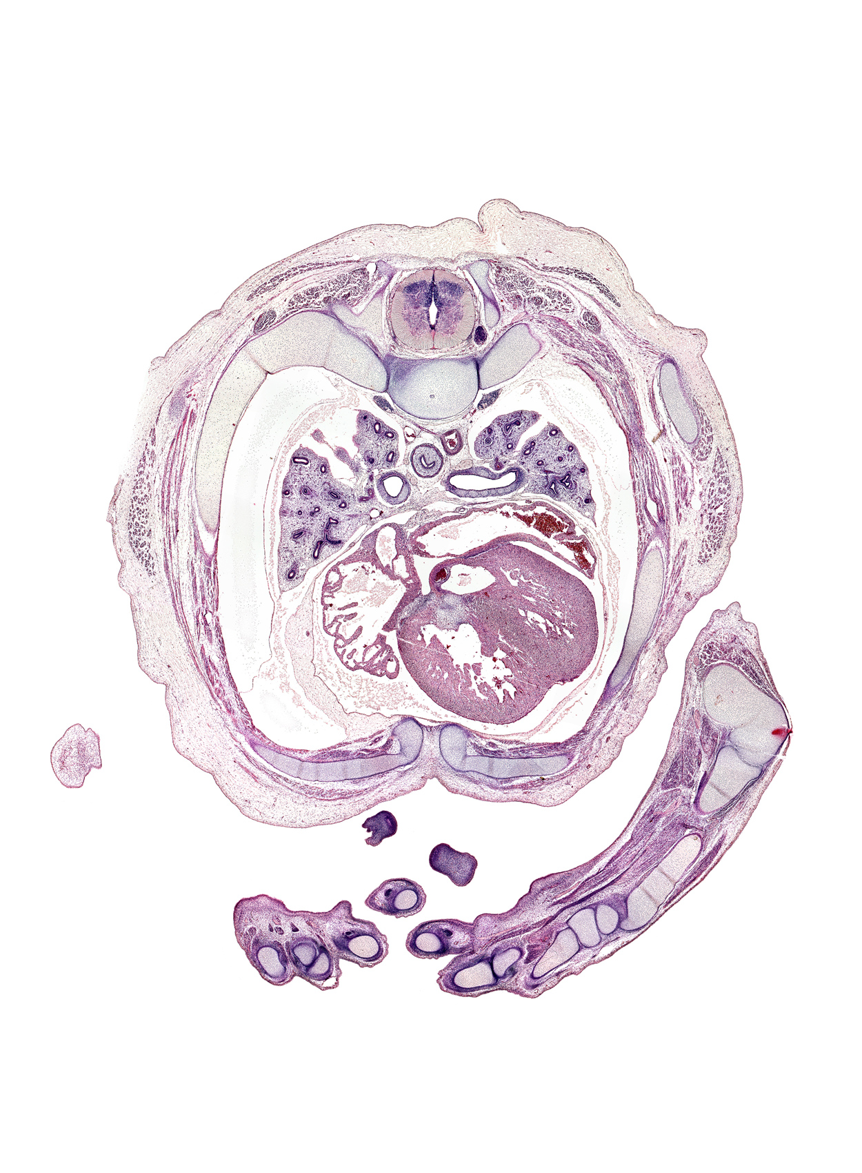 T-4 intercostal nerve, T-4 spinal ganglion, aorta, aortic vestibule of left ventricle, artifact(s), digit 5 (little finger), edge of elbow, head of rib 5, hypothenar eminence, intermediate phalynx of digit 2 (index finger), junction of sinus venosus of right atrium and superior vena cava, latissimus dorsi muscle, left atrium, lower lobe of left lung, lumbrical muscle, metacarpal 3, metacarpal 4, metacarpophalangeal joint of digit 4 (ring finger), muscular interventricular septum, notochord, palm, posterior intercostal artery, pulmogenic mesenchyme, rib 5, rib 6, styloid process of ulna, tip of left digit 1 (thumb), trabecular part of left ventricle, trapezius muscle