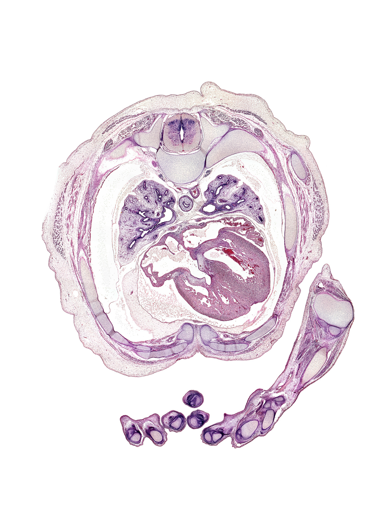 T-4 / T-5 interganglion region, atrioventricular sulcus, central tendon of heart, chordae tendinae, hemisternum, iliocostalis muscle, interventricular sulcus, left atrium, left upper pulmonary vein, left venous valve, left ventricle, longissimus muscle, lower secondary bronchus, metacarpal 5, oblique fissure, posterior intercostal artery, primary interatrial septum (septum primum), proximal interphalangeal joint of digit 3 (middle finger), rib 5, rib 6, rib 7, right atrium, right upper pulmonary vein, right venous valve, right ventricle, scapula, serratus anterior muscle, sinus venosus, spinalis muscle, trapezius muscle