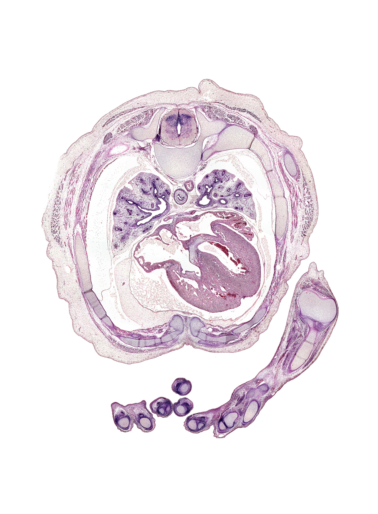 T-4 / T-5 interganglion region, aorta, azygos vein, central tendon of heart, dorsal median septum, esophagus, intermediate phalynx of digit 2 (index finger), internal thoracic artery, lateral tertiary bronchus, left atrium, left phrenic nerve, left upper pulmonary vein, lower lobe of left lung, lower lobe of right lung, medial tertiary bronchus, metacarpal 5, middle lobe of right lung, middle secondary bronchus, oblique fissure, primary interatrial septum (septum primum), proximal interphalangeal joint of digit 3 (middle finger), rib 5, rib 6, rib 7, right atrium, right phrenic nerve, right upper pulmonary vein, sinus venosus, trabecular part of left ventricle, trapezius muscle, ulna, upper lobe of left lung