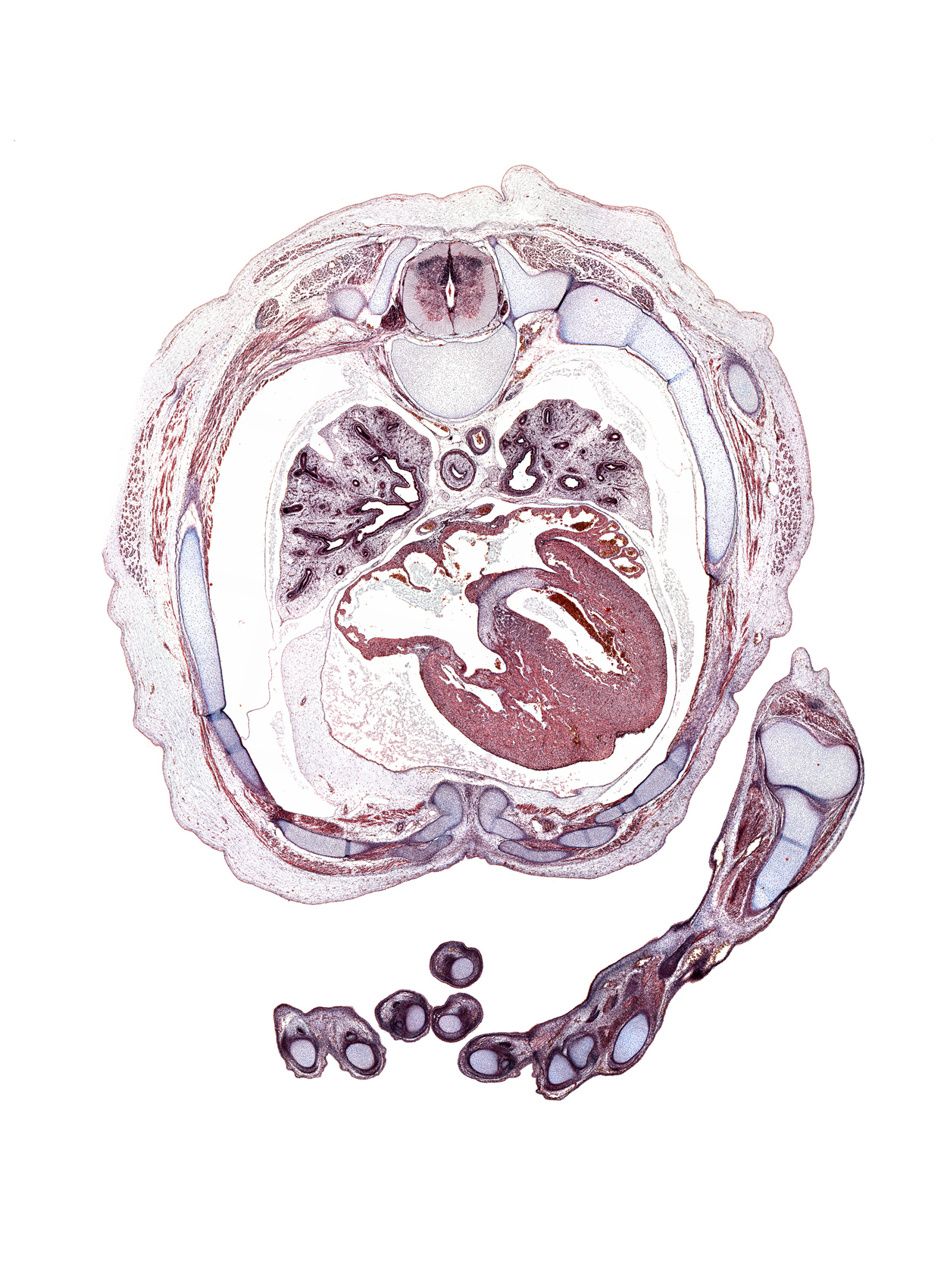 T-5 spinal ganglion, aorta, artifact(s), azygos vein, external intercostal muscle(s), flexor digitorum tendons, hypothenar eminence, inferior tertiary bronchus, innermost intercostal muscle(s), interdigital notch, intermediate phalynx of digit 3 (middle finger), internal intercostal muscle(s), lateral epicondyle of humerus, lateral tertiary bronchus, left atrium, left digit 2 (index finger), medial tertiary bronchus, membranous part of interventricular septum, metacarpophalangeal joint of digit 4 (ring finger), pericardial sac, rib 5, rib 6, rib 7, rib 8, right atrium, secondary interatrial foramen (foramen secundum), sternocostal muscle, trapezius muscle, upper lobe of left lung, volar surface of right digit 3 (middle finger)