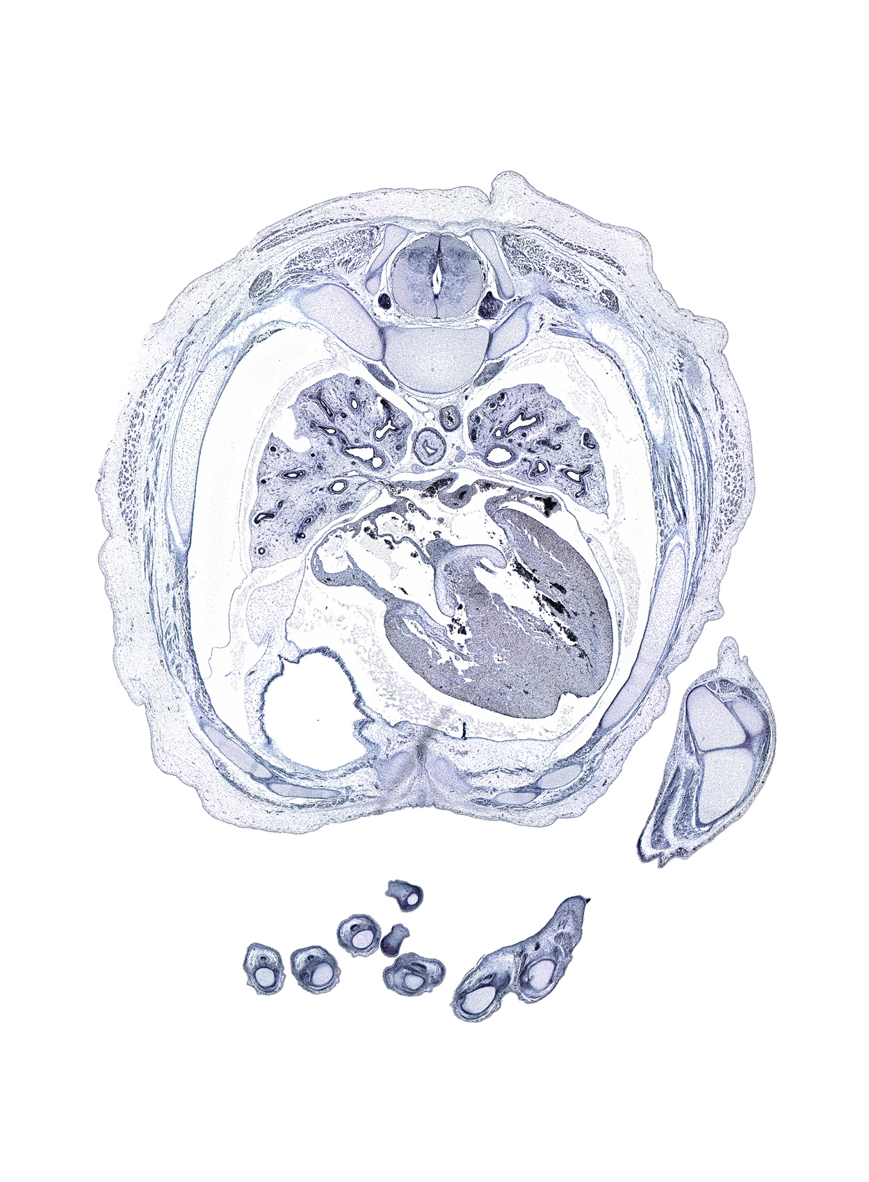 T-5 spinal ganglion, azygos vein, central tendon of diaphragm, cephalic edge of peritoneal cavity, dorsal funiculus, entrance of common pulmonary vein into left atrium, intermediate phalynx of digit 3 (middle finger), lateral funiculus, left atrioventricular canal, left phrenic nerve, loose mesenchyme, lower lobe of left lung, metacarpal 5, olecranon process of ulna, palmar surface of left hand, pericardial cavity, pericardial sac, proximal end of ulna, rib 6, rib 8, right atrioventricular canal, subcostal muscle, tip of left digit 2 (index finger), trochlea of humerus, ventral funiculus