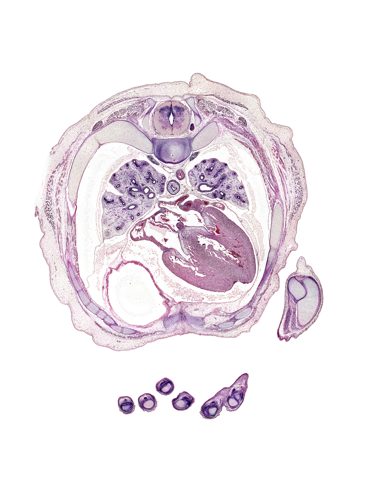 T-5 spinal ganglion, common left pulmonary vein, common right pulmonary vein, head of rib 6, interdigital notch, intermediate phalynx of left digit 3 (middle finger), interventricular sulcus, left ventricle, lower lobe of right lung, metacarpophalangeal joint of left digit 5 (little finger), middle lobe of right lung, muscular interventricular septum, oblique fissure, pericardial cavity, peritoneal cavity, pleural cavity, rib 6, rib 7, rib 8, right atrioventricular (tricuspid) valve, right atrium, right ventricle, secondary interatrial septum (septum secundum), secondary ostium, sympathetic trunk, trapezius muscle, volar surface of digit 3 (middle finger)