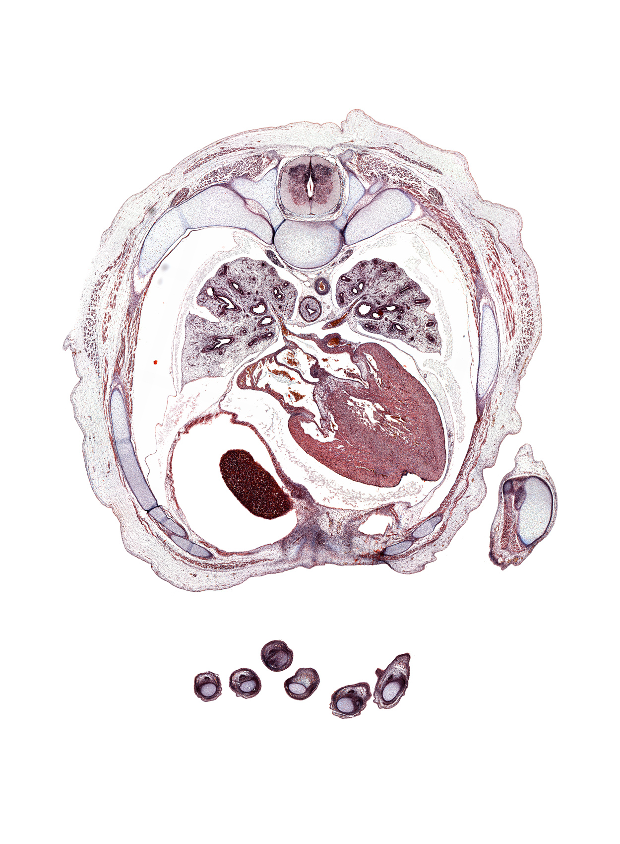 T-5 / T-6 interganglion region, aorta, azygos vein, cephalic edge of liver, coronary sinus, distal interphalangeal joint of digit 3 (middle finger), external intercostal muscle(s), iliocostalis muscle, innermost intercostal muscle(s), internal intercostal muscle(s), left upper pulmonary vein, longissimus muscle, oblique fissure, proximal phalynx of left digit 5 (little finger), rectus abdominis muscle, rib 6, rib 8, right digit 3 (middle finger), right digit 5 (little finger), right lower pulmonary vein, spinalis muscle, ulna, xiphoid