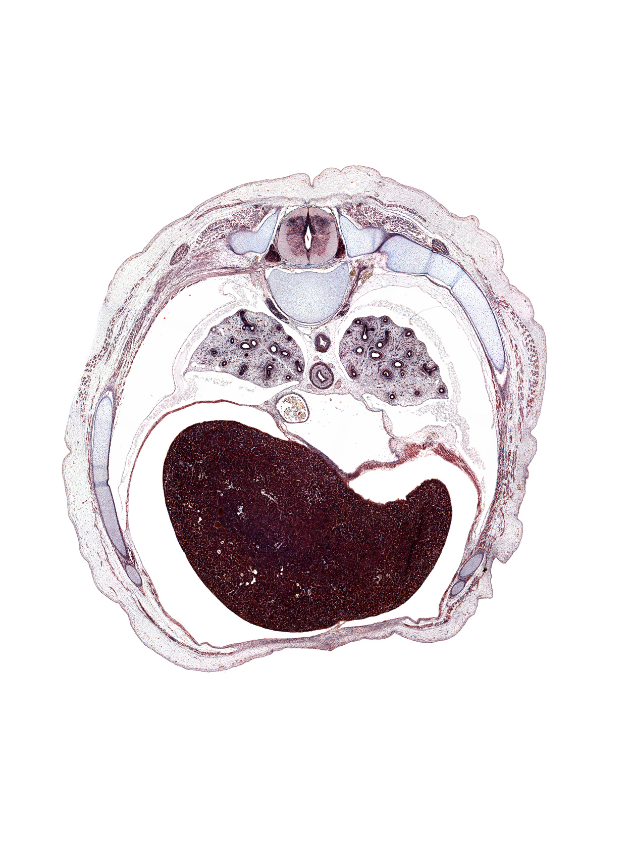 T-7 spinal ganglion, artifact(s), central tendon of diaphragm, costal margin, falciform ligament, iliocostalis muscle, inferior vena cava, latissimus dorsi muscle, left lobe of liver, linea alba, longissimus muscle, loose mesenchyme, phrenic nerve, rib 7, rib 8, rib 9, right lobe of liver, spinalis muscle, trapezius muscle