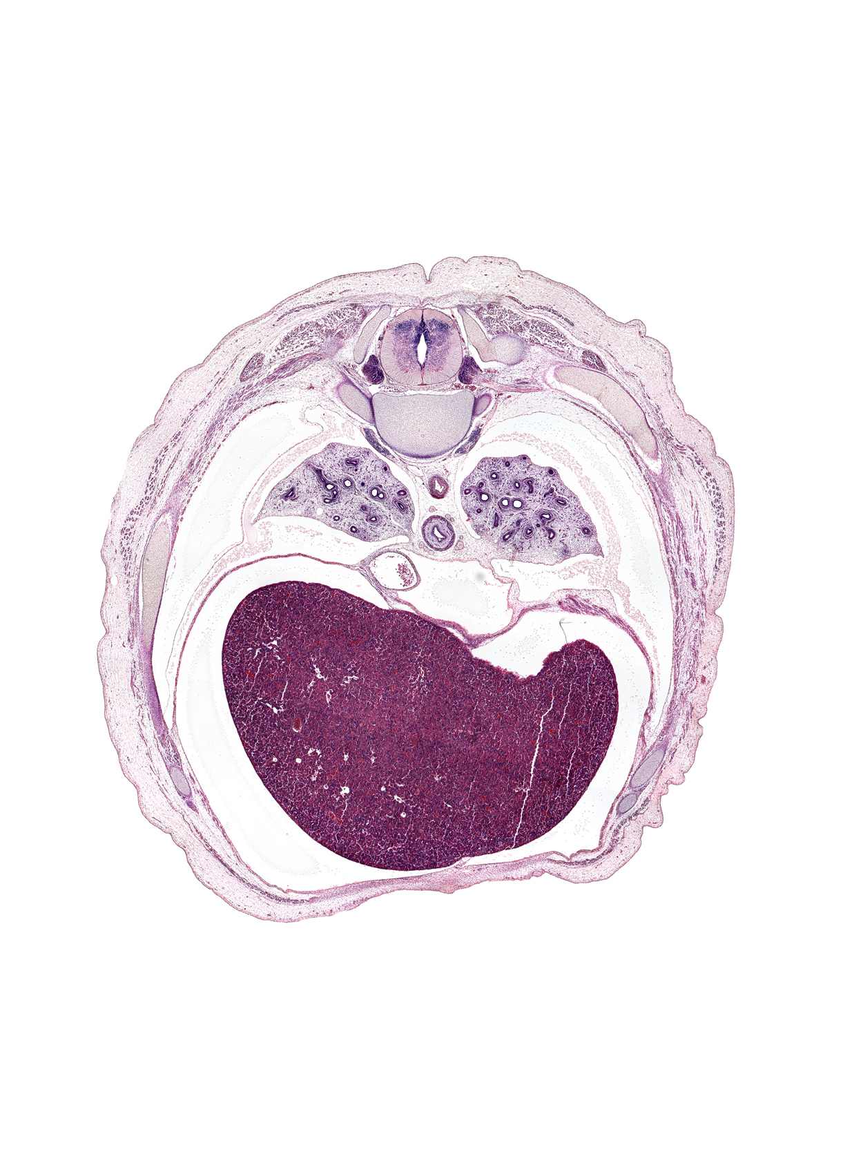 T-7 intercostal nerve, T-7 spinal ganglion, anterior rectus sheath, aorta, artifact fracture(s), central tendon of diaphragm, esophagus endoderm, external abdominal oblique muscle, falciform ligament, inferior vena cava, left lobe of liver, pericardial cavity, pericardial sac, peritoneal cavity, pulmogenic mesenchyme, pulmonary ligament, rib 8, rib 9, right lobe of liver, sympathetic trunk, trapezius muscle