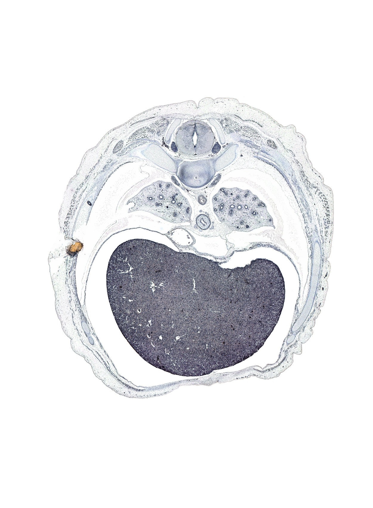 T-7 / T-8 intervertebral disc, T-7 spinal ganglion, artifact(s), caudal edge of pericardial cavity, head of rib 8, inferior vena cava, latissimus dorsi muscle, left lobe of liver, liver prominence, lower lobe of left lung, lower lobe of right lung, peritoneal cavity, pleural recess, rectus abdominis muscle, rib 8, rib 9, right lobe of liver, serratus anterior muscle, trapezius muscle