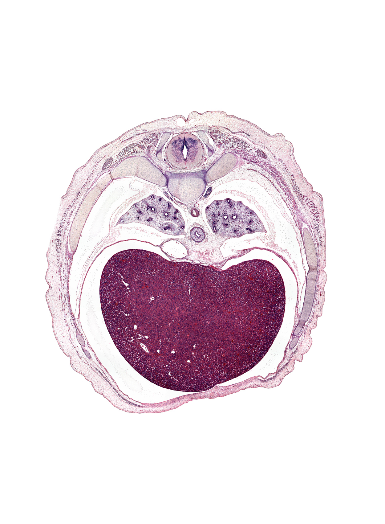 T-7 / T-8 interganglion region, anterior rectus sheath, artifact(s), azygos vein, central canal, esophageal nerve plexus, falciform ligament, inferior vena cava, innermost intercostal muscle(s), left lobe of liver, loose mesenchyme, muscular part of diaphragm, neural arch, peritoneal cavity, pleural recess, pulmonary ligament, rib 8, right lobe of liver, sympathetic trunk