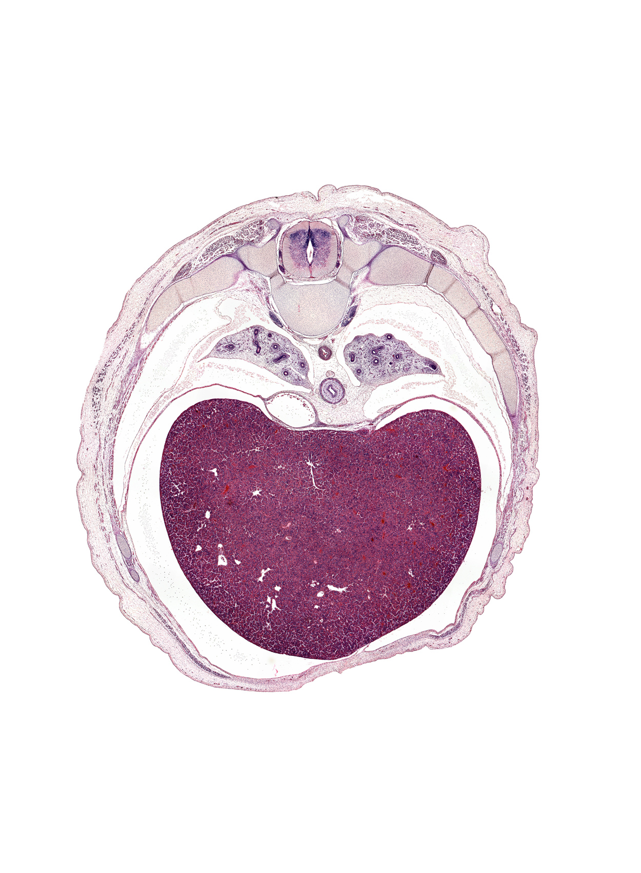 T-8 spinal ganglion, anterior gastric nerve (CN X), aorta, central tendon of diaphragm, dorsal median septum, falciform ligament, inferior vena cava, left lobe of liver, lower lobe of left lung, lower lobe of right lung, mesenchymal coat, peritoneal cavity, pleural cavity, pleural recess, posterior gastric nerve (CN X), pulmonary ligament, rib 8, rib 9, right lobe of liver, ventral median septum