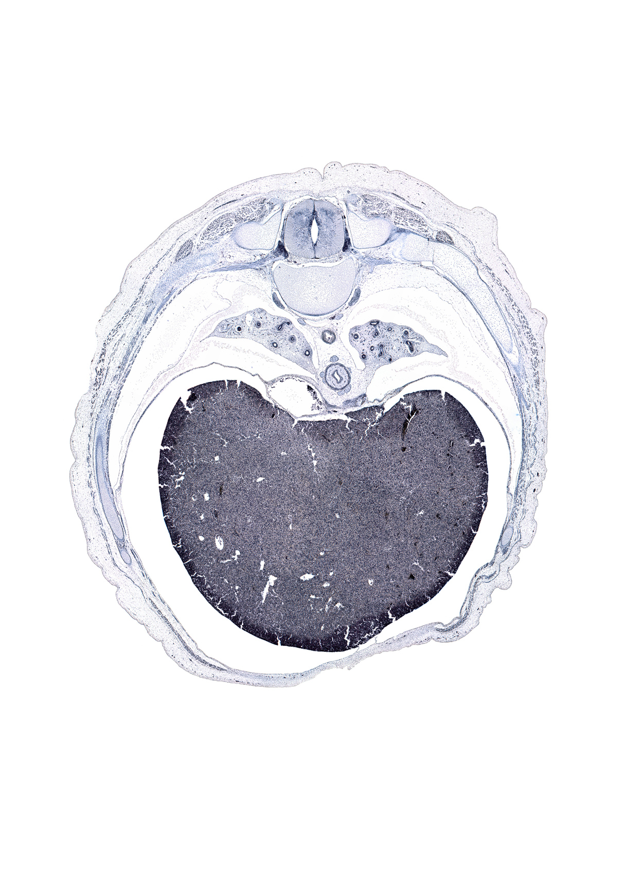 T-8 spinal ganglion, artifact(s), azygos vein anastomosis, central canal, greater splanchnic nerve, intervertebral foramen, left lobe of liver, muscular part of diaphragm, neural arch of T-8 vertebra, peritoneal cavity, pulmogenic mesenchyme, rectus abdominis muscle, rib 8, rib 9, right lobe of liver, supra-umbilical part of abdominal wall, sympathetic trunk, transverse process of T-8 vertebra