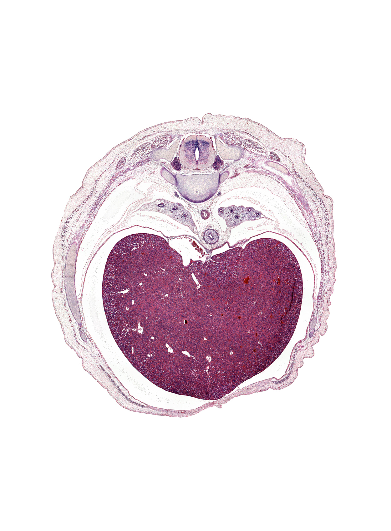 T-8 intercostal nerve, T-8 spinal ganglion, central canal, costal margin, inferior vena cava, latissimus dorsi muscle, left lobe of liver, liver prominence, loose mesenchyme, lower lobe of left lung, lower lobe of right lung, notochord, rectus abdominis muscle, rib 10, rib 9, right lobe of liver, surface ectoderm, trapezius muscle