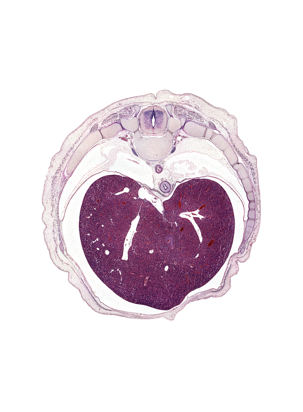 T-8 / T-9 interganglion region, anterior rectus sheath, caudal edge of lower lobe of right lung, costotransverse joint, edge of umbilical cord, efferent hepatic vein, efferent hepatic veins, esophagus muscularis, left lobe of liver, loose mesenchyme, muscular part of diaphragm, peritoneal cavity, posterior rectus sheath, rib 10, rib 9, right lobe of liver, sympathetic trunk