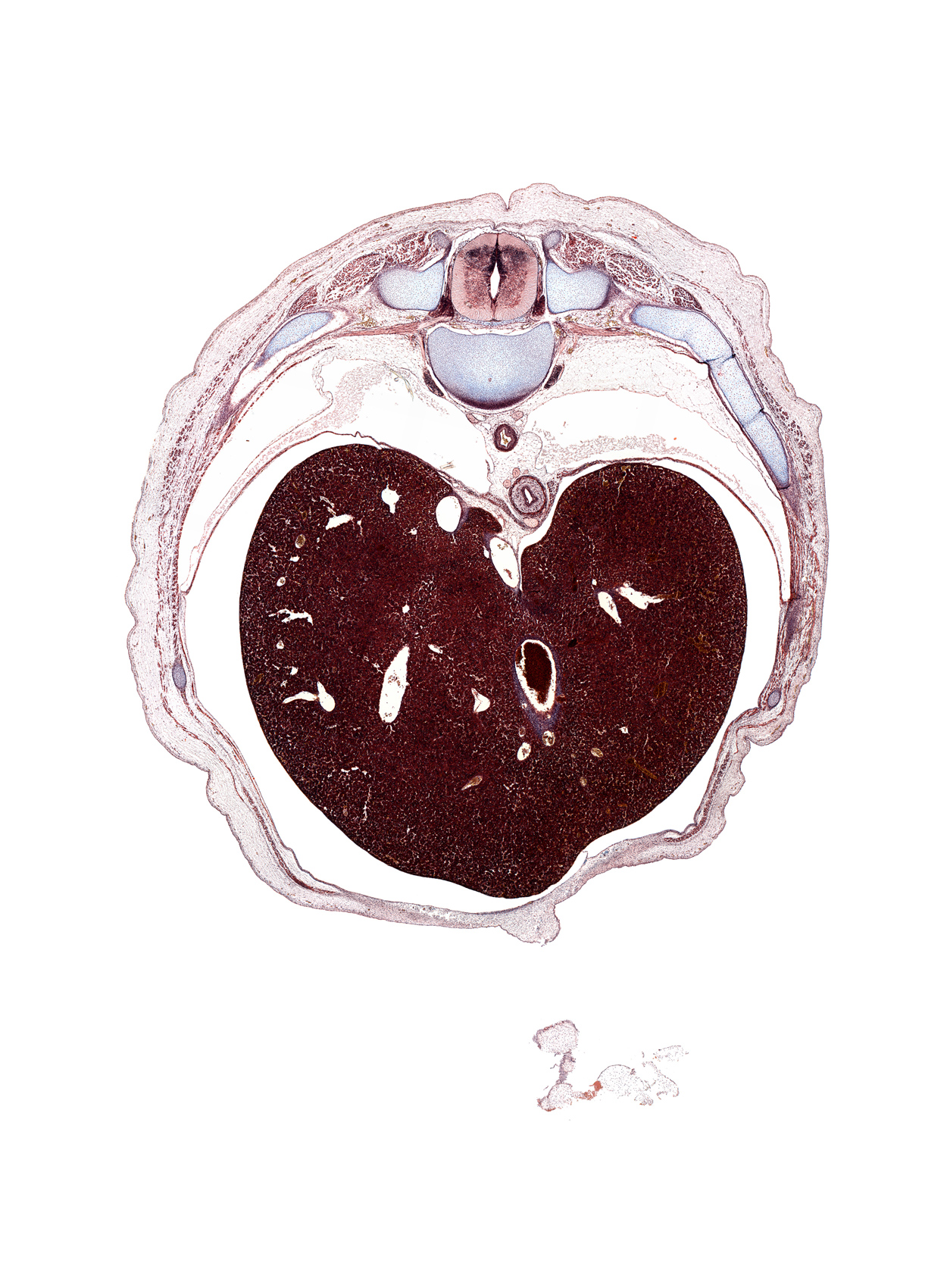 T-9 intercostal nerve, T-9 spinal ganglion, anterior rectus sheath, central canal, cephalic edge of ductus venosus, dorsal horn of grey matter, edge of umbilical cord, external abdominal oblique muscle, innermost intercostal muscle(s), internal abdominal oblique muscle, internal intercostal muscle(s), lateral horn of grey matter, pleural cavity, posterior rectus sheath, rib 10, rib 9, transversus abdominis muscle, ventral horn of grey matter