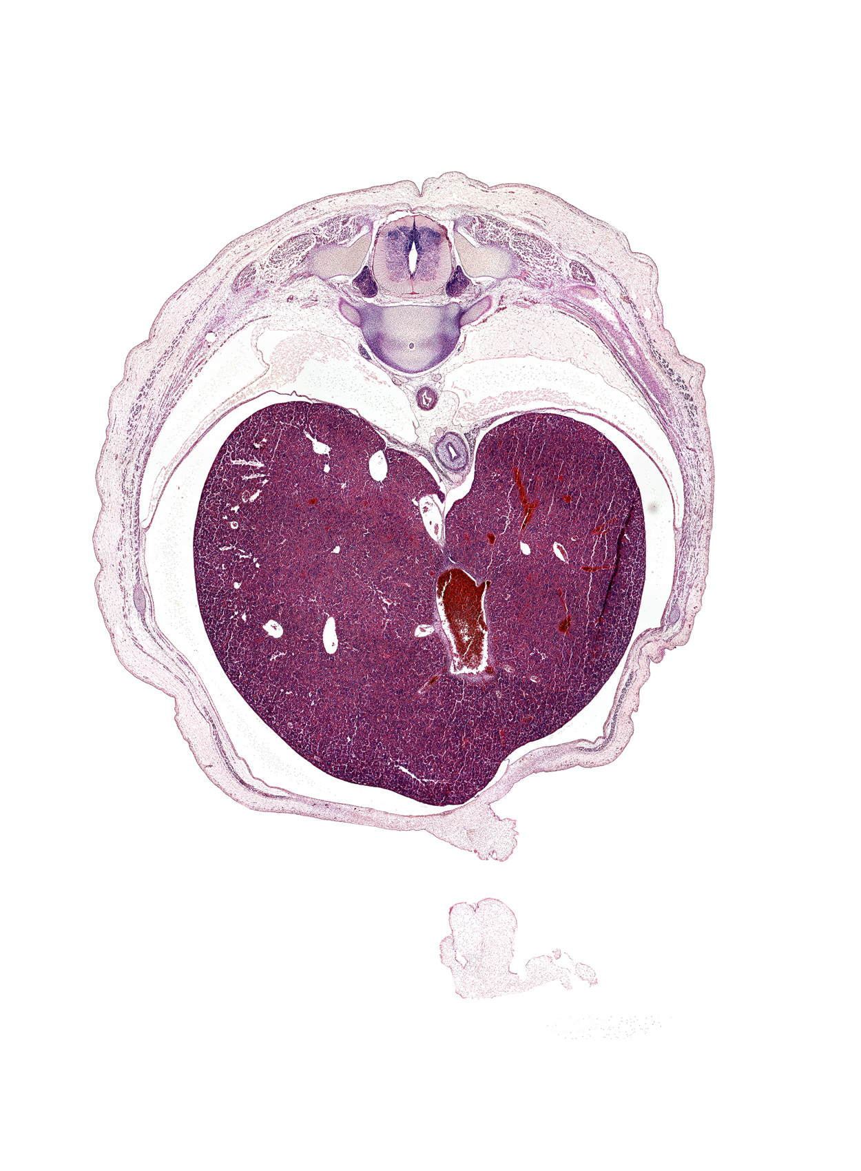 T-9 / T-10 intervertebral disc, T-9 spinal ganglion, aorta, dorsal funiculus, ductus venosus, esophagus muscularis, external abdominal oblique aponeurosis, external abdominal oblique muscle, head of rib 10, inferior vena cava, lateral funiculus, latissimus dorsi muscle, left lobe of liver, liver prominence, peritoneal cavity, rectus abdominis muscle, rib 10, right lobe of liver, umbilical cord, ventral funiculus