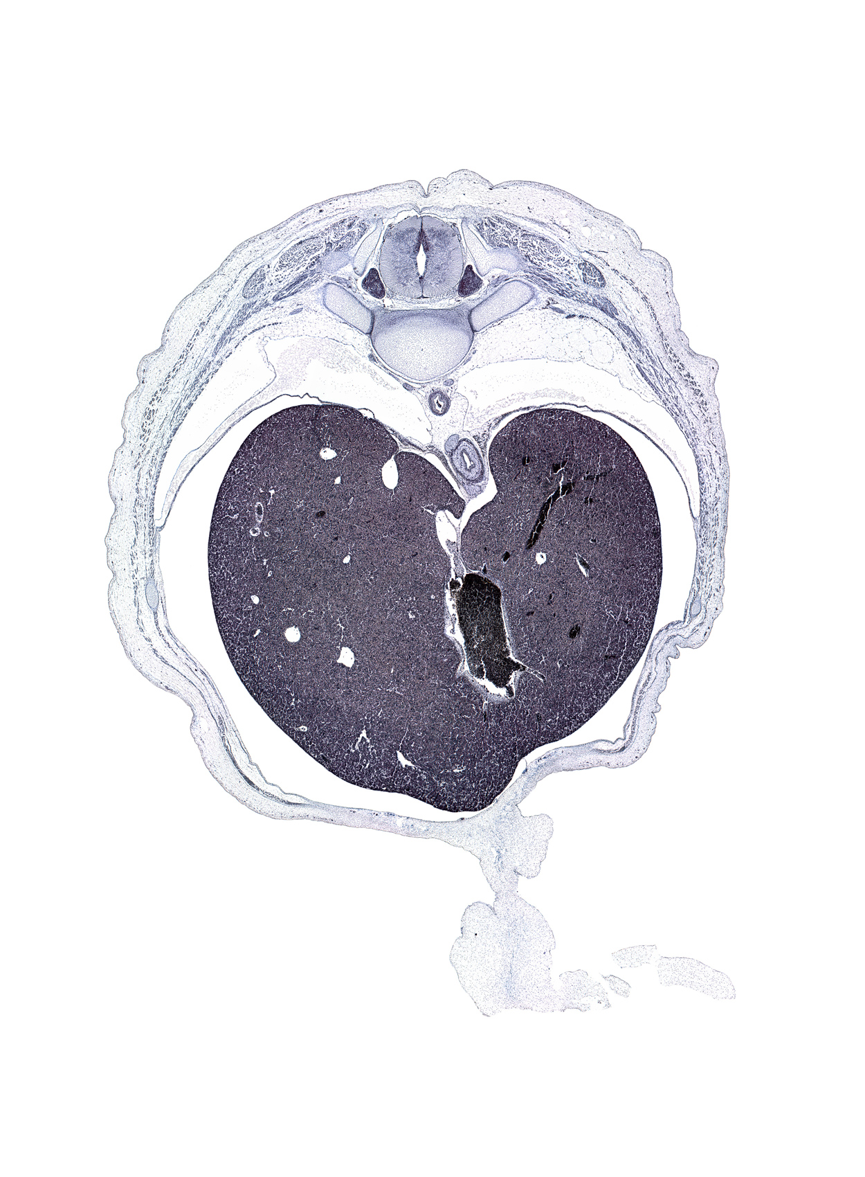 T-9 spinal ganglion, afferent hepatic vein, amnion on surface of umbilical cord, anterior gastric nerve (CN X), caudate lobe of liver, ductus venosus, esophageal hiatus in diaphragm, inferior vena cava, latissimus dorsi muscle, left lobe of liver, muscular part of diaphragm, posterior gastric nerve (CN X), rib 10, right lobe of liver, surface ectoderm, sympathetic trunk, thoracolumbar fascia, tubercle of rib 9, umbilical cord