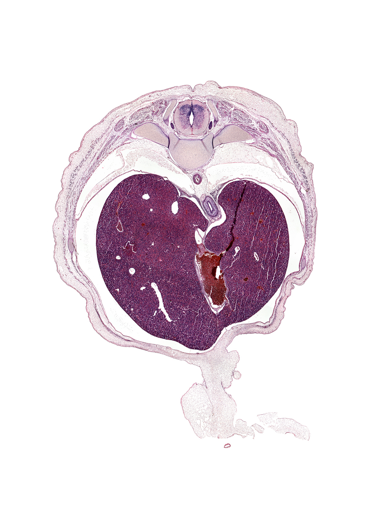 T-9 spinal ganglion, amnion on surface of umbilical cord, artifact(s), ductus venosus, esophagus endoderm, greater splanchnic nerve, iliocostalis muscle, inferior vena cava, left lobe of liver, longissimus muscle, osteogenic layer, pleural cavity, rib 10, right lobe of liver, spinalis muscle, surface ectoderm, umbilical cord