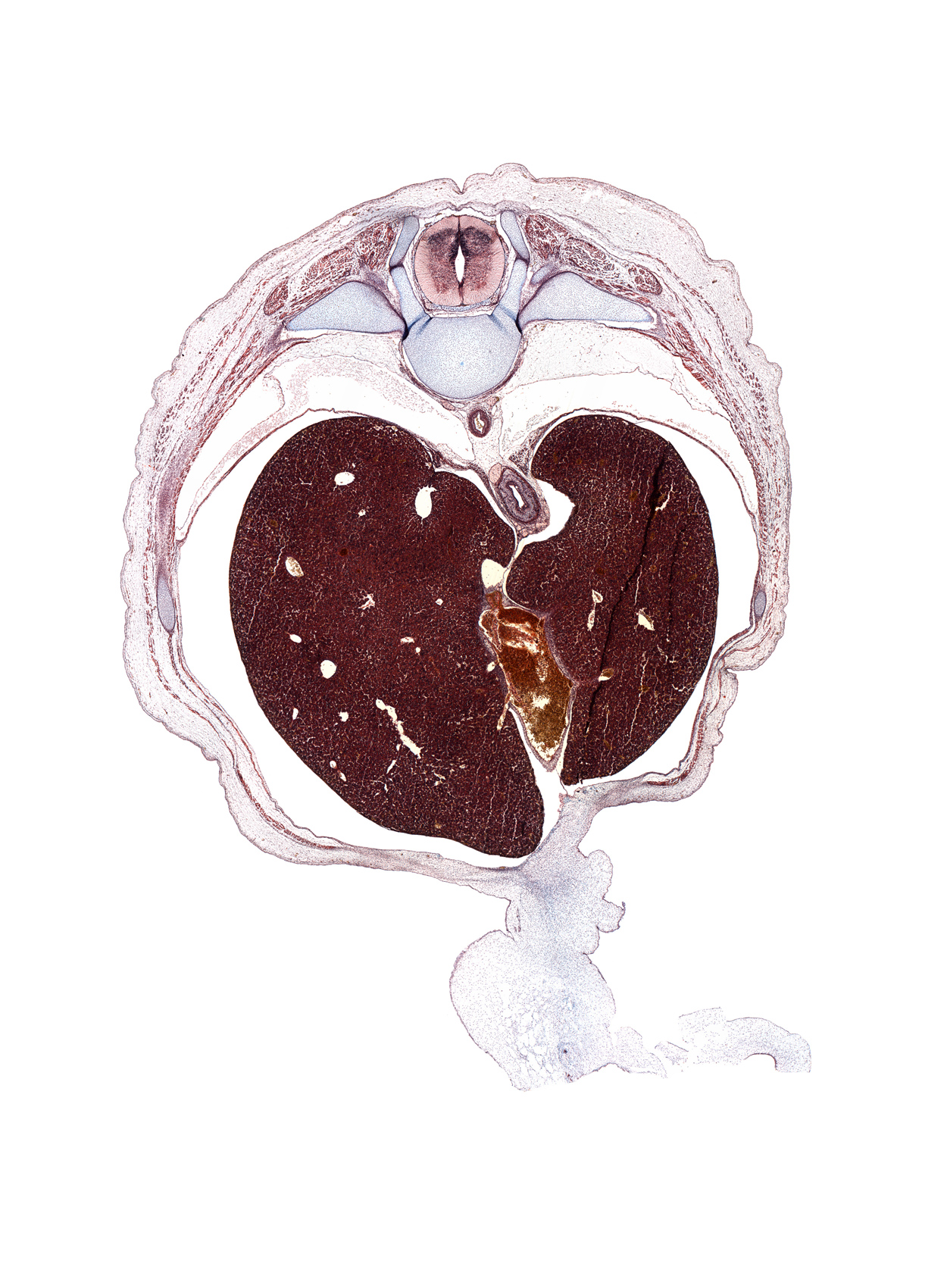 T-9 / T-10 interganglion region, afferent hepatic vein, aorta, costal margin, ductus venosus, esophageal hiatus in diaphragm, external abdominal oblique muscle, inferior vena cava, intermediate zone, internal abdominal oblique muscle, left lobe of liver, loose mesenchyme, marginal zone, posterior gastric nerve (CN X), rib 10, transversus abdominis muscle, umbilical cord, ventricular zone