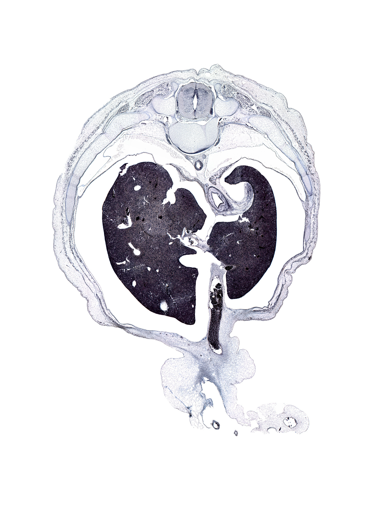 T-9 spinal ganglion, artifact(s), caudate lobe of liver, dorsal median septum, ductus venosus, esophagus lumen, hilum of liver, inferior vena cava, left lobe of liver, loose mesenchyme, pedicle of T-10 vertebra, pleural recess, rib 10, right lobe of liver, umbilical coelom, umbilical vein, ventral median septum