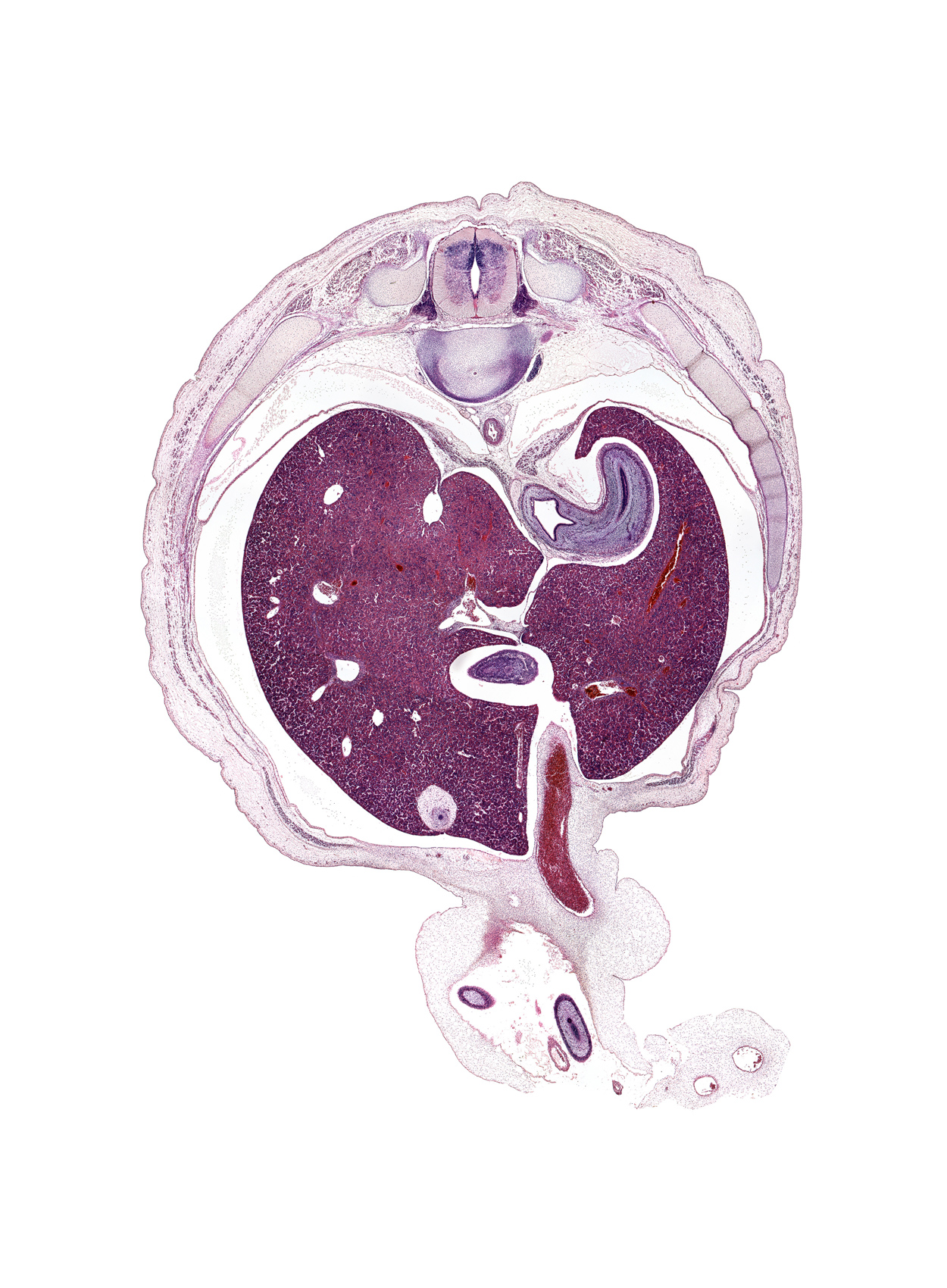 T-10 / T-11 intervertebral disc, T-10 spinal ganglion, T-10 spinal nerve, artifact separation(s), caudate lobe of liver, cephalic edge of duodenum (first part), cephalic edge of gall bladder, distal limb of herniated midgut, ductus venosus, fundus of stomach, inferior vena cava, junction of esophagus and stomach, left lobe of liver, lesser omentum, omphalomesenteric artery, proximal limb of herniated midgut, rib 10, right crus of diaphragm, right lobe of liver, umbilical coelom, umbilical cord, umbilical vein