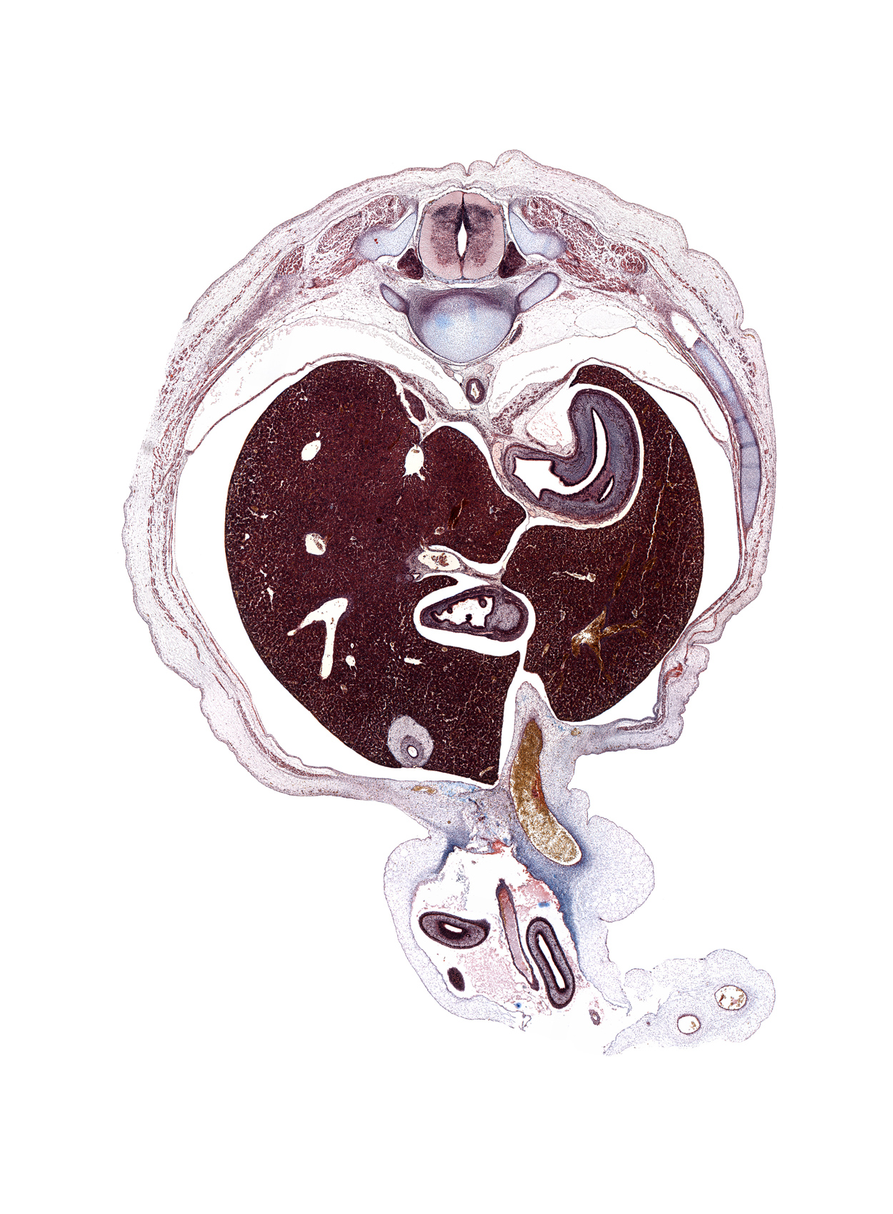 T-10 intercostal nerve, T-10 spinal ganglion, T-11 / T-12 intervertebral disc, aorta, cardiac orifice, cephalic edge of suprarenal gland cortex, distal limb of herniated midgut, dorsal funiculus, duodenum (first part), fundus of stomach, gall bladder, inferior vena cava, lateral funiculus, left lobe of liver, left umbilical artery, omphalomesenteric artery, proximal limb of herniated midgut, pyloric sphincter, quadrate lobe of liver, rib 10, umbilical vein, ventral funiculus