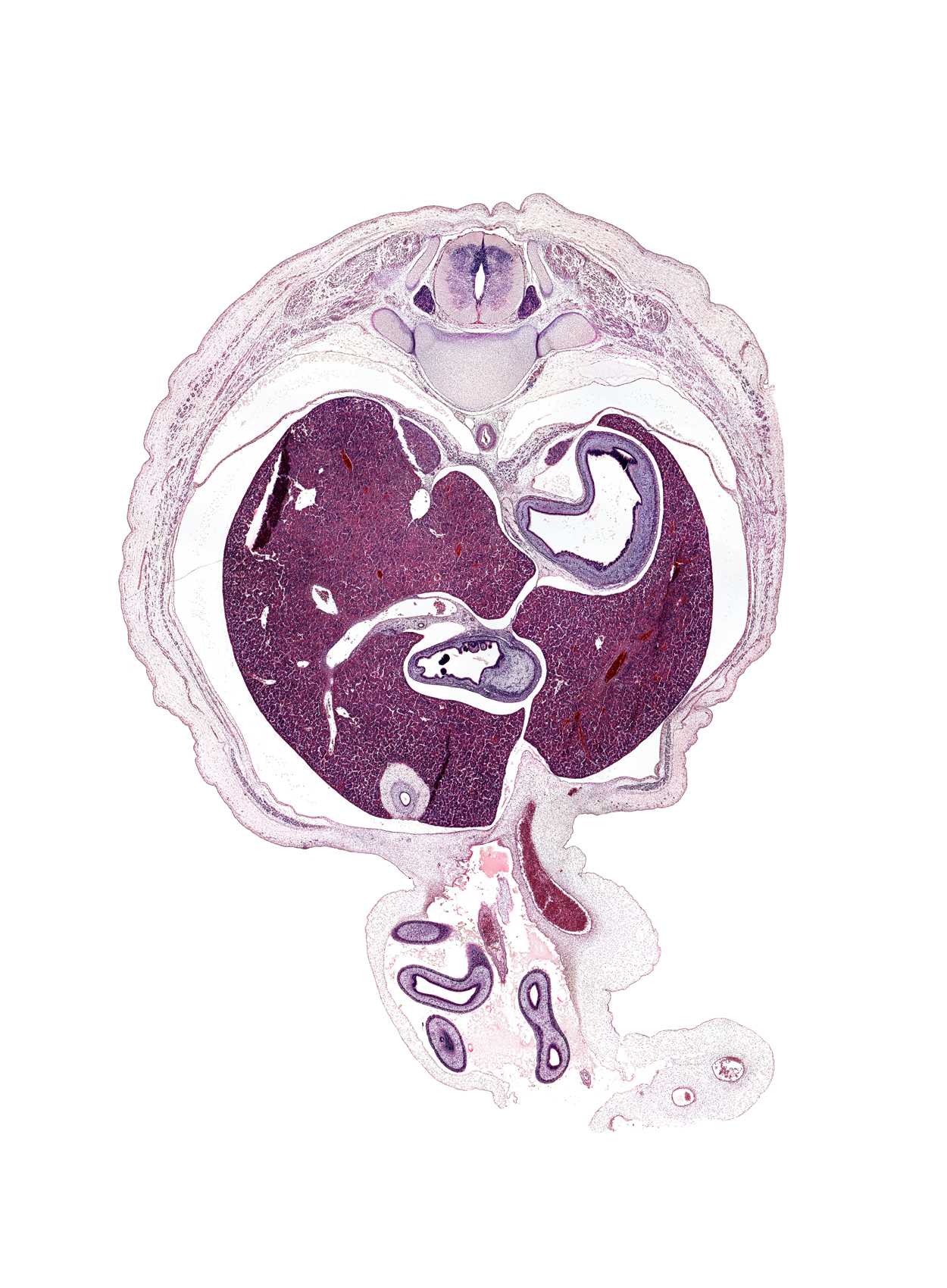 T-10 spinal ganglion, aorta, approximate midpoint of herniated midgut, artifact separation(s), artifact(s), caudate lobe of liver, cephalic edge of suprarenal gland cortex, distal limb of herniated midgut, duodenum (first part), gall bladder, greater curvature of stomach, head of rib 11, hepatic portal vein, inferior vena cava, left lobe of liver, proximal limb of herniated midgut, pylorus of stomach, right lobe of liver, superior mesenteric artery, suprarenal gland cortex, umbilical coelom, umbilical cord, umbilical vein