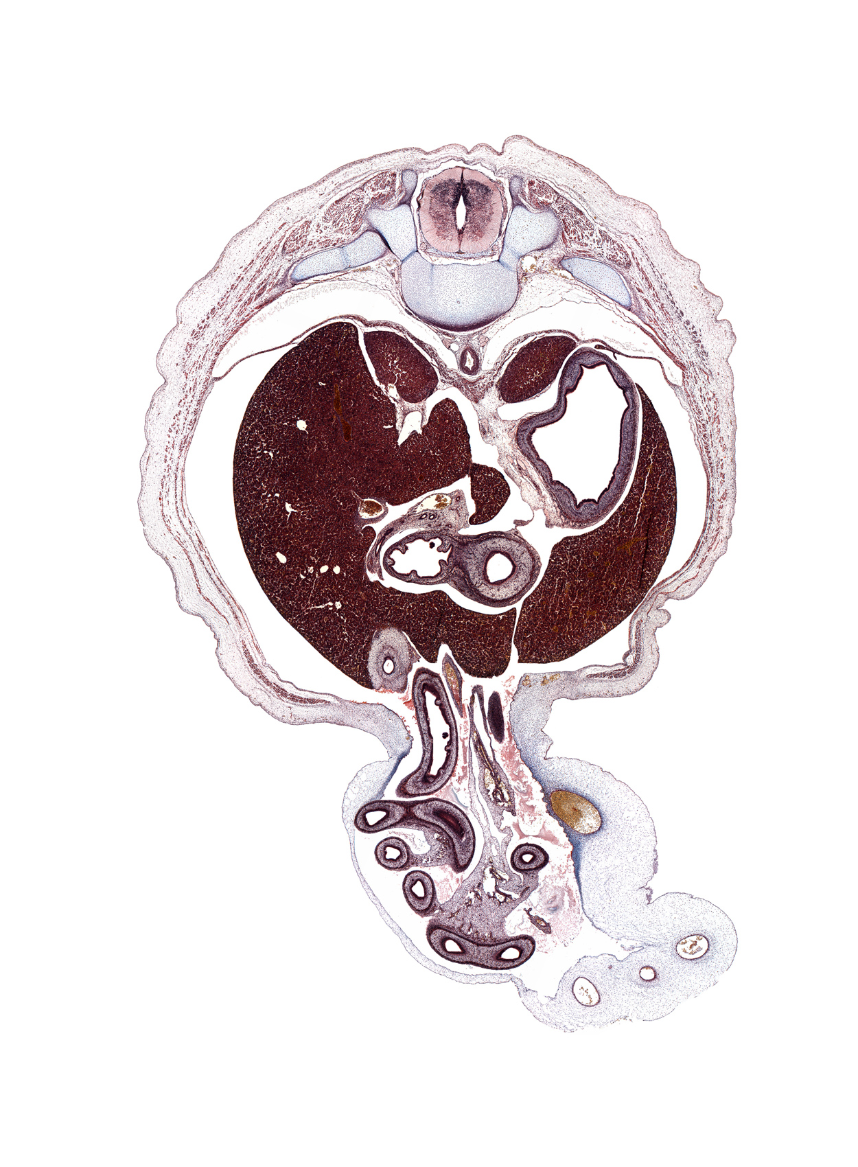 T-10 / T-11 interganglion region, allantois, aorta, azygos vein, cystic duct, distal limb of herniated midgut, duodenal fold, duodenum (first part), duodenum (fourth part), gall bladder, gastric fold(s), left lobe of liver, peritoneal cavity, pleural recess, proximal limb of herniated midgut, pylorus of stomach, rib 11, right lobe of liver, suprarenal gland cortex, umbilical vein