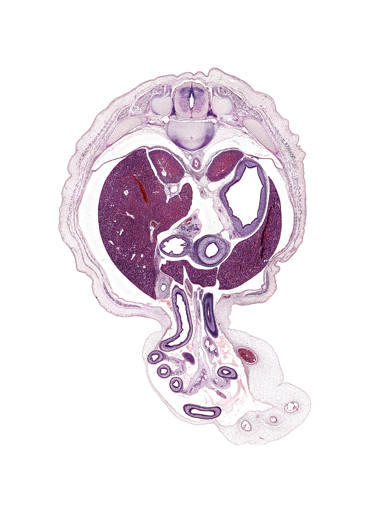 T-11 / T-12 intervertebral disc, T-11 spinal ganglion, allantois, cystic duct, distal limb of herniated midgut, dorsal mesogastrium, duodenum (second part), epiploic foramen, gall bladder, hepatic portal vein, junction of hindgut and midgut, left gastric artery, left lobe of liver, left umbilical artery, lumen of body of stomach, notochord, proximal limb of herniated midgut, pylorus of stomach, rib 11, right lobe of liver, subarachnoid space, superior mesenteric artery, superior mesenteric vein, suprarenal gland cortex, umbilical vein