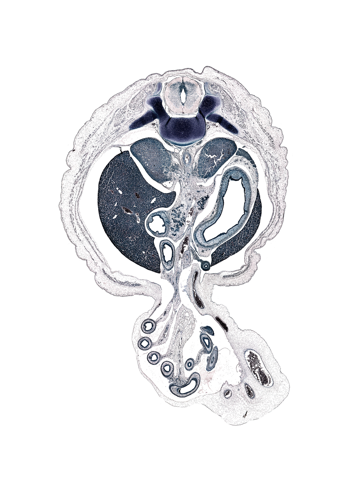 T-11 / T-12 interganglion region, allantois, aorta, appendix, celiac ganglion, distal limb of herniated midgut, duodenal fold, greater curvature of stomach, head of pancreas, left umbilical artery, lesser curvature of stomach, lumen of pyloric antrum of stomach, pleural recess, proximal limb of herniated midgut, rib 12, right umbilical artery, superior mesenteric vein, suprarenal gland cortex, umbilical cord, umbilical vein