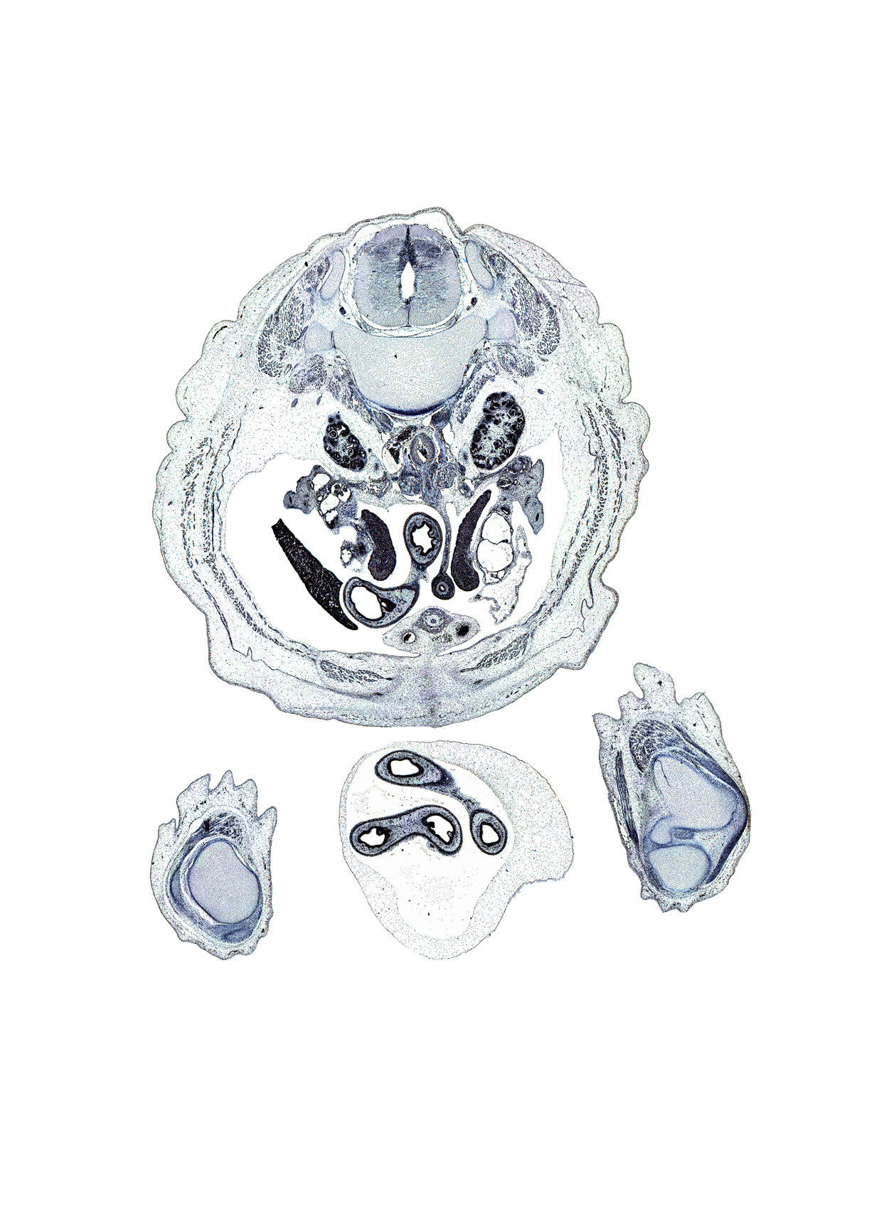 L-1 spinal ganglion, dorsal mesogastrium, duodenum (fourth part), duodenum (third part), inferior mesenteric artery, kidney (metanephros), lesser sac (omental bursa), mesonephric vesicle(s), osteogenic layer, patella, patellar ligament, proximal limb of herniated midgut, quadriceps femoris tendon, right lobe of liver, sartorius muscle, subarachnoid space, testis, transverse process of L-2 vertebra, umbilical coelom, umbilical cord, ureter, vastus medialis muscle