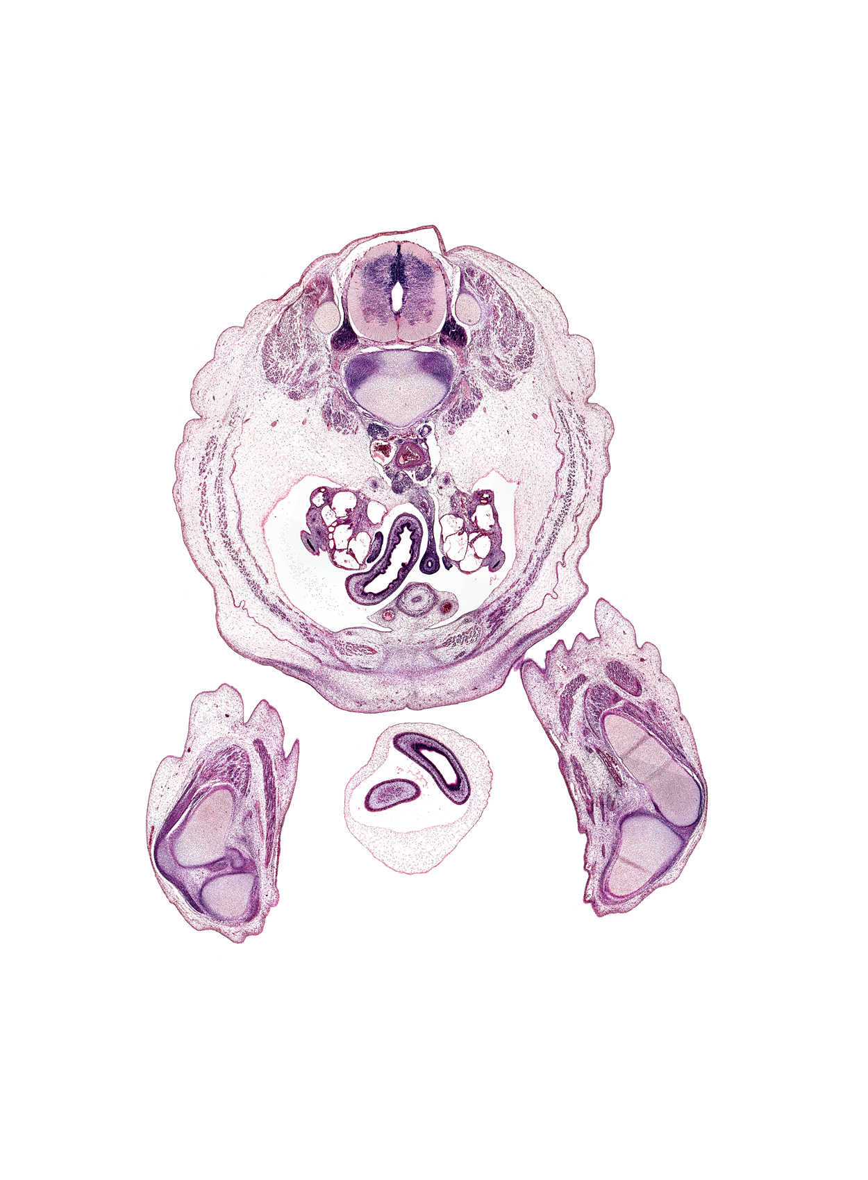 L-2 / L-3 intervertebral disc, L-2 spinal ganglion, L-2 spinal nerve, aortic bifurcation, caudal end of testis, duodenum (fourth part), gracilis muscle, hindgut, inferior mesenteric artery, intermediate zone, knee joint, left umbilical artery, marginal zone, mesonephric duct, paramesonephric duct, patellar ligament, popliteal fossa, proximal limb of herniated midgut, rectus femoris muscle, right umbilical artery, sartorius muscle, tibia, ureter, urinary bladder muscularis, ventricular zone