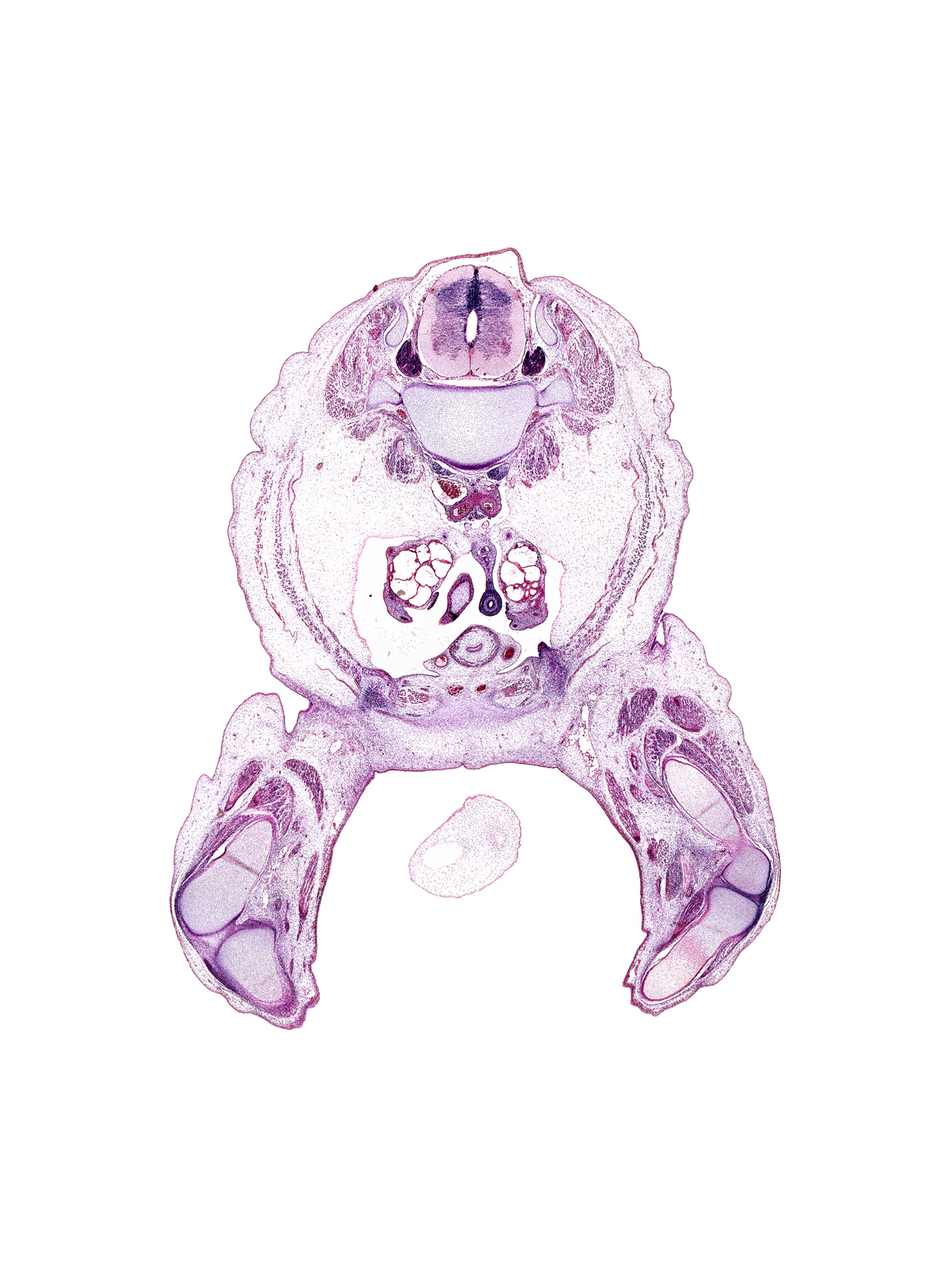 L-2 spinal ganglion, caudal edge of duodenum, caudal edge of umbilical coelom, degenerating mesonephros, dorsal median septum, femoral artery, femoral nerve, femur, gracilis muscle, gubernaculum of testis, hindgut, hindgut mesentery, inferior vena cava, knee joint, left common iliac artery, lumbar plexus, medial condyle of femur, medial condyle of tibia, mesonephric duct, paramesonephric duct, psoas major muscle, quadratus lumborum muscle, right umbilical artery, sartorius muscle, sympathetic trunk, tibia, umbilical cord, ureter, urinary bladder muscularis, ventral median septum