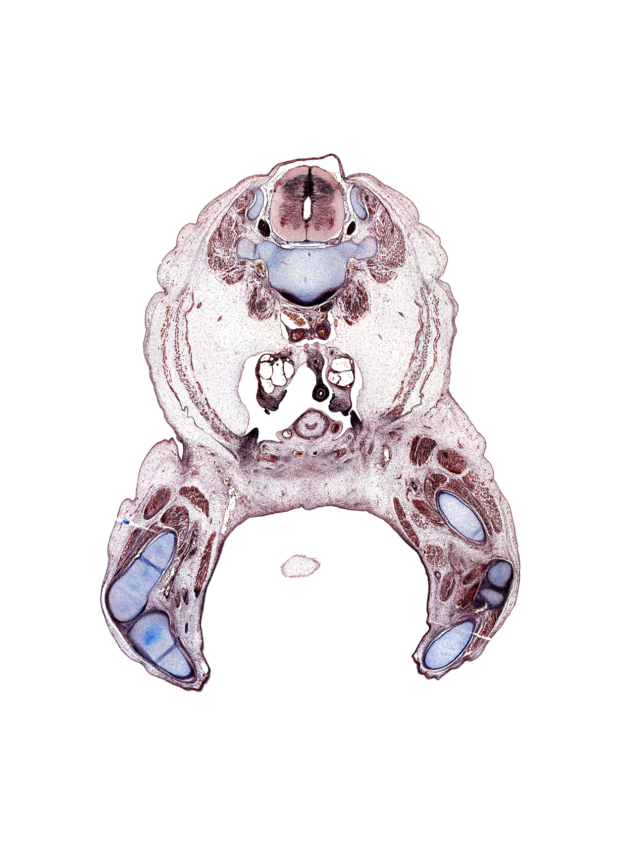 L-2 spinal ganglion, artifact(s), caudal edge of umbilical cord, degenerating mesonephros, femur, gubernaculum of testis, iliocostalis muscle, inferior epigastric artery, knee joint, left common iliac artery, left umbilical artery, longissimus muscle, medial condyle of femur, medial condyle of tibia, multifidus muscle, peritoneal cavity, popliteal artery, psoas major muscle, quadratus lumborum muscle, semimembranosus muscle, semitendinosus muscle, testis, tibia, tibial nerve, urinary bladder muscularis