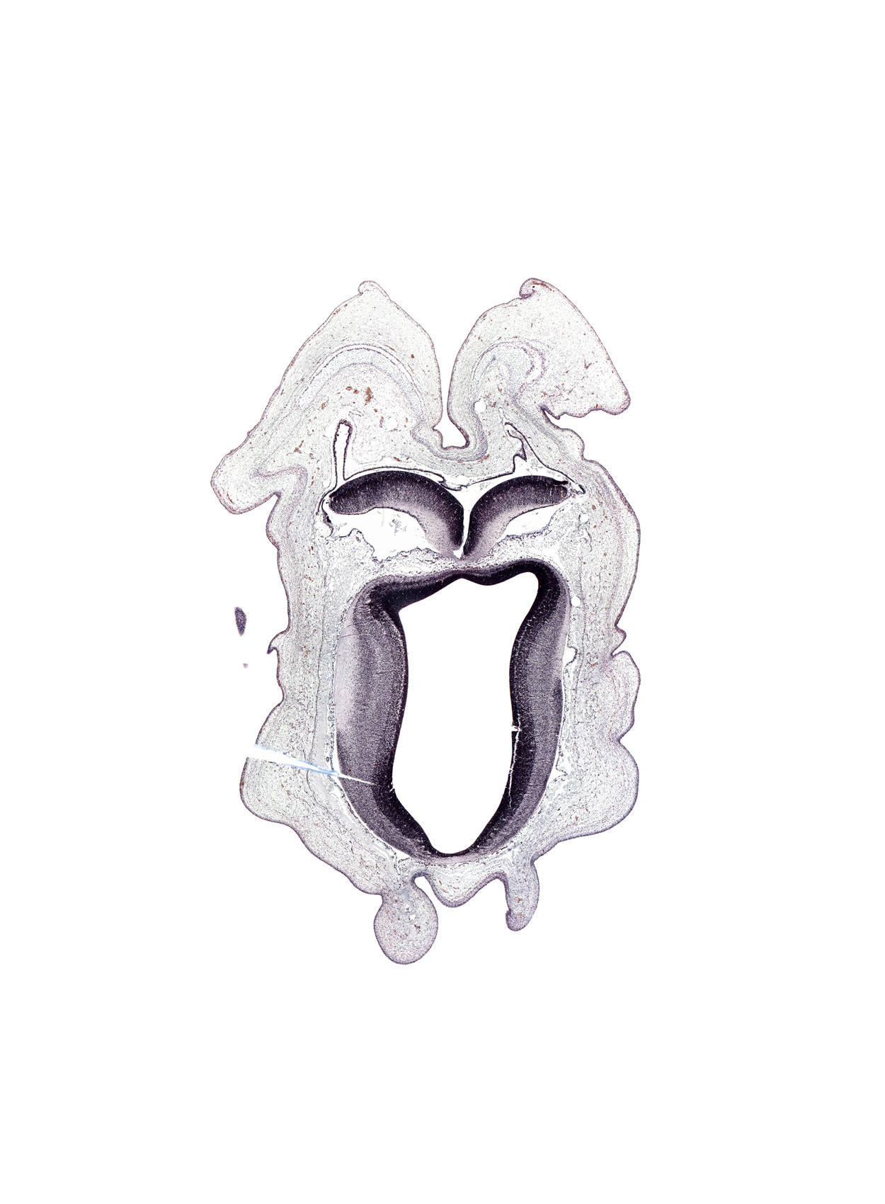 alar plate of mesencephalon, alar plate of metencephalon (cerebellum), artifact space(s), artifact(s), cerebral aqueduct (mesocoele), rhombencoel (fourth ventricle), roof plate of mesencephalon, roof plate of metencephalon