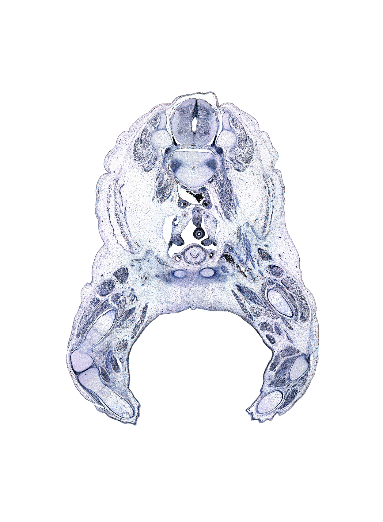 L-2 spinal ganglion, L-3 / L-4 intervertebral disc, L-3 dorsal primary ramus, L-3 spinal ganglion, L-3 ventral primary ramus, body of pubis, femoral artery, femoral nerve, femur, gracilis muscle, gubernaculum of testis, intervertebral foramen, knee joint, medial head of gastrocnemius muscle, multifidus muscle, neural arch, notochord, pectineus muscle, psoas major muscle, subarachnoid space, tibia, tibial nerve, transverse process, ureter