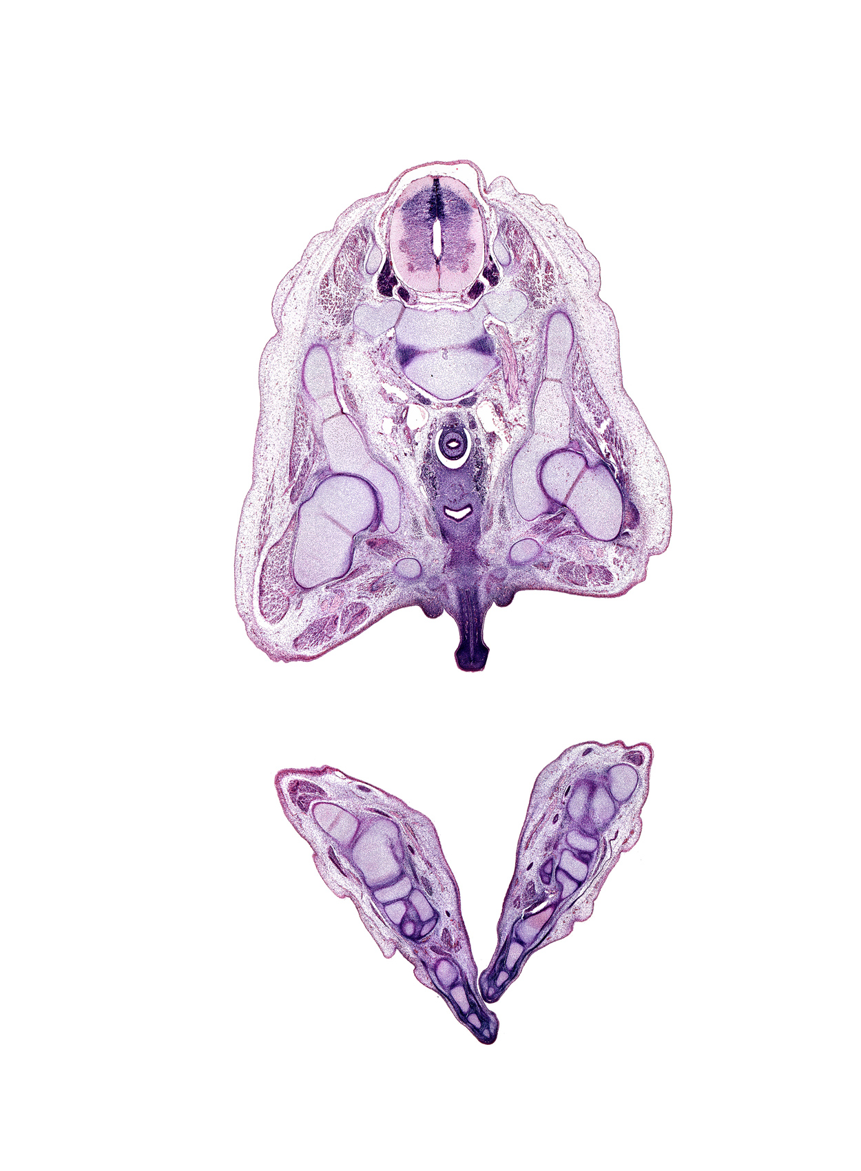 L-4 spinal ganglion, L-5 / S-1 intervertebral disc, L-5 spinal ganglion, calcaneal tendon, corpus cavernosum, cuneiform 2, digit 2 (foot), distal phalynx of digit 2 (foot), fibula, glans penis, gluteus minimus muscle, greater trochanter of femur, head of femur, ischiorectal fossa, lumbosacral trunk, medial plantar nerve, metatarsal 2, middle phalynx, navicular, notochord, obturator externus muscle, obturator foramen, obturator internus muscle, proximal phalynx (foot), rectum, right common iliac vein, sciatic nerve, scrotal swelling, talus, tensor fasciae latae muscle, urethra