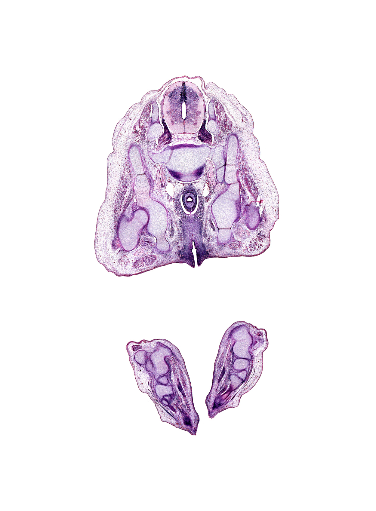 L-5 / S-1 intervertebral disc, L-5 spinal ganglion, S-1 / S-2 intervertebral region, S-1 ventral primary ramus, ala of sacrum, calcaneum, caudal edge of peritoneal cavity, central canal, cuboid, cuneiform 3, fibula, fibularis longus and fibularis brevis muscles, flexor digitorum brevis muscle, gluteus medius muscle, gluteus minimus muscle, iliac crest, ischiorectal fossa, junction of urethra and urethral groove, metatarsal 3 base, neural arch, obturator internus muscle, plantar interosseus muscle, quadratus plantae muscle, rectum endoderm, sacral plexus, sciatic nerve, superior gluteal artery, superior gluteal nerve, talus, urethral fold, urethral groove