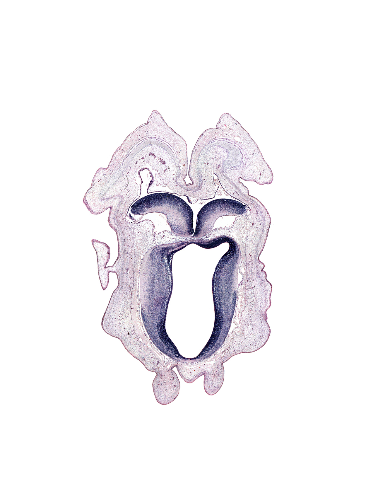 alar plate of metencephalon (cerebellum), artifact space(s), artifact(s), cerebral aqueduct (mesocoele), commissure of superior colliculus, rhombencoel (fourth ventricle), roof plate of metencephalon, root of trochlear nerve (CN IV), tectum of mesencephalon