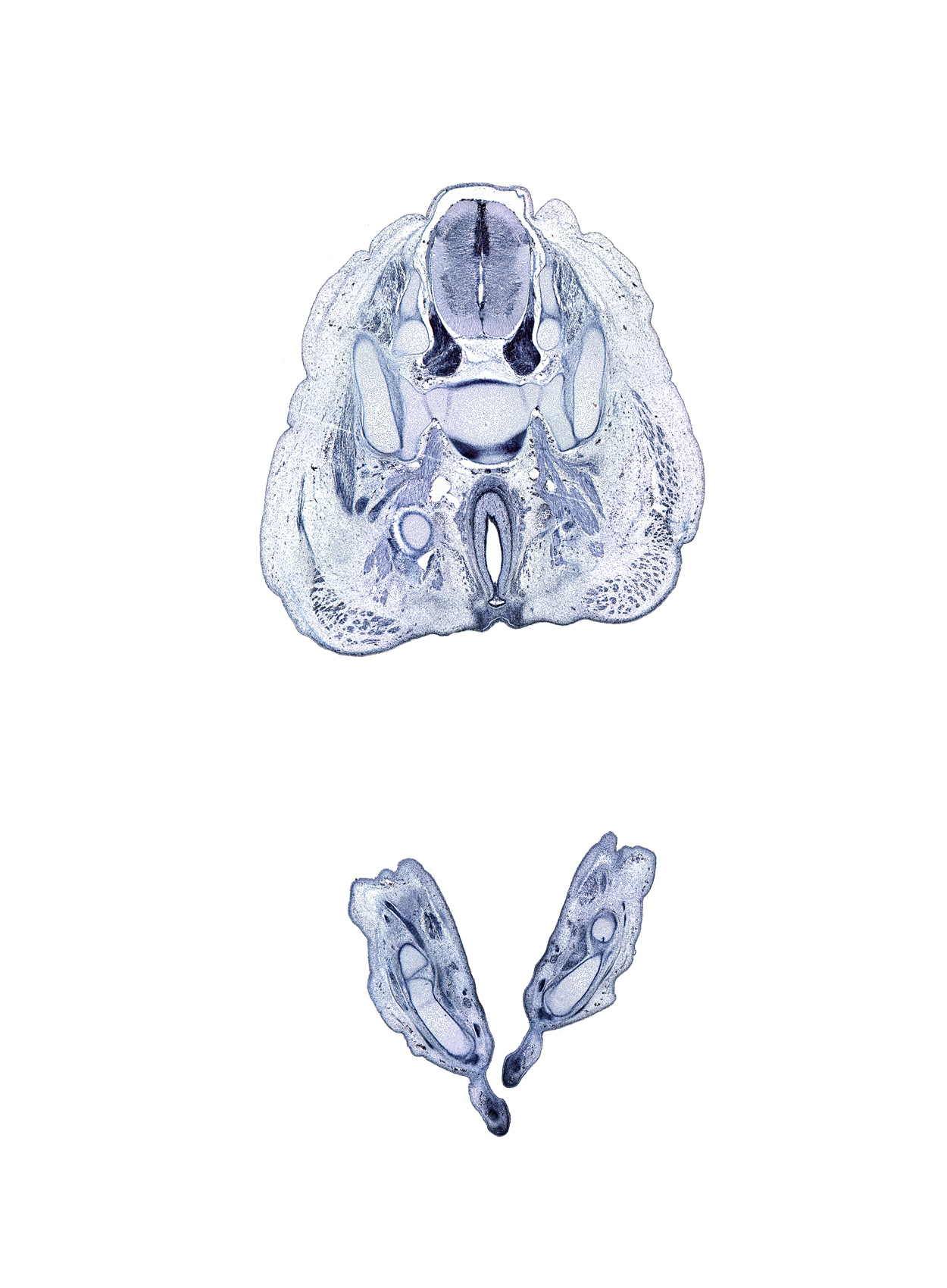S-1 spinal ganglion, S-2 ventral primary ramus, anal canal, anal pit, anal tubercle, artifact(s), coccygeus muscle, cuboid, dorsal horn of grey matter, fibularis brevis tendon, fibularis longus tendon, gluteus maximus muscle, greater sciatic foramen, metatarsal 4, sacral plexus, sacro-iliac joint, sciatic nerve, ventral horn of grey matter