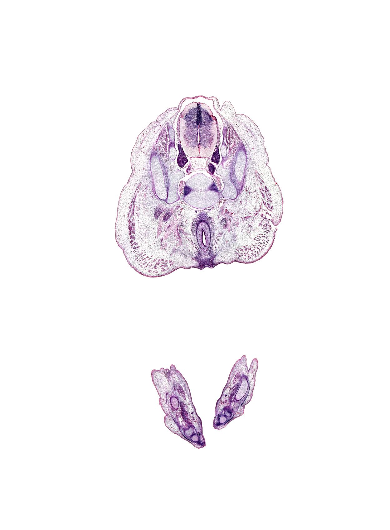 S-1 dorsal root, S-1 spinal ganglion, S-2 / S-3 intervertebral region, S-2 spinal ganglion, S-2 ventral primary ramus, anal pit, anal sphincter, artifact(s), cuboid, extensor digitorum longus tendon, flexor digitorum longus tendon, gluteus maximus muscle, ilium, levator ani muscle, metatarsal 4, notochord, osteogenic layer, plantar interosseus muscle, rectum lumen, sacro-iliac joint