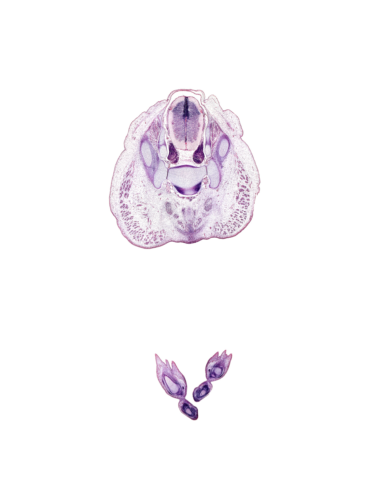 S-2 spinal ganglion, S-3 / S-4 intervertebral region, S-3 ventral primary ramus, caudal eminence, coccygeus muscle, fibularis brevis tendon, gluteus maximus muscle, ilium, levator ani muscle, metatarsal 5, metatarsal 5 head, neural arch, subarachnoid space, tuberosity