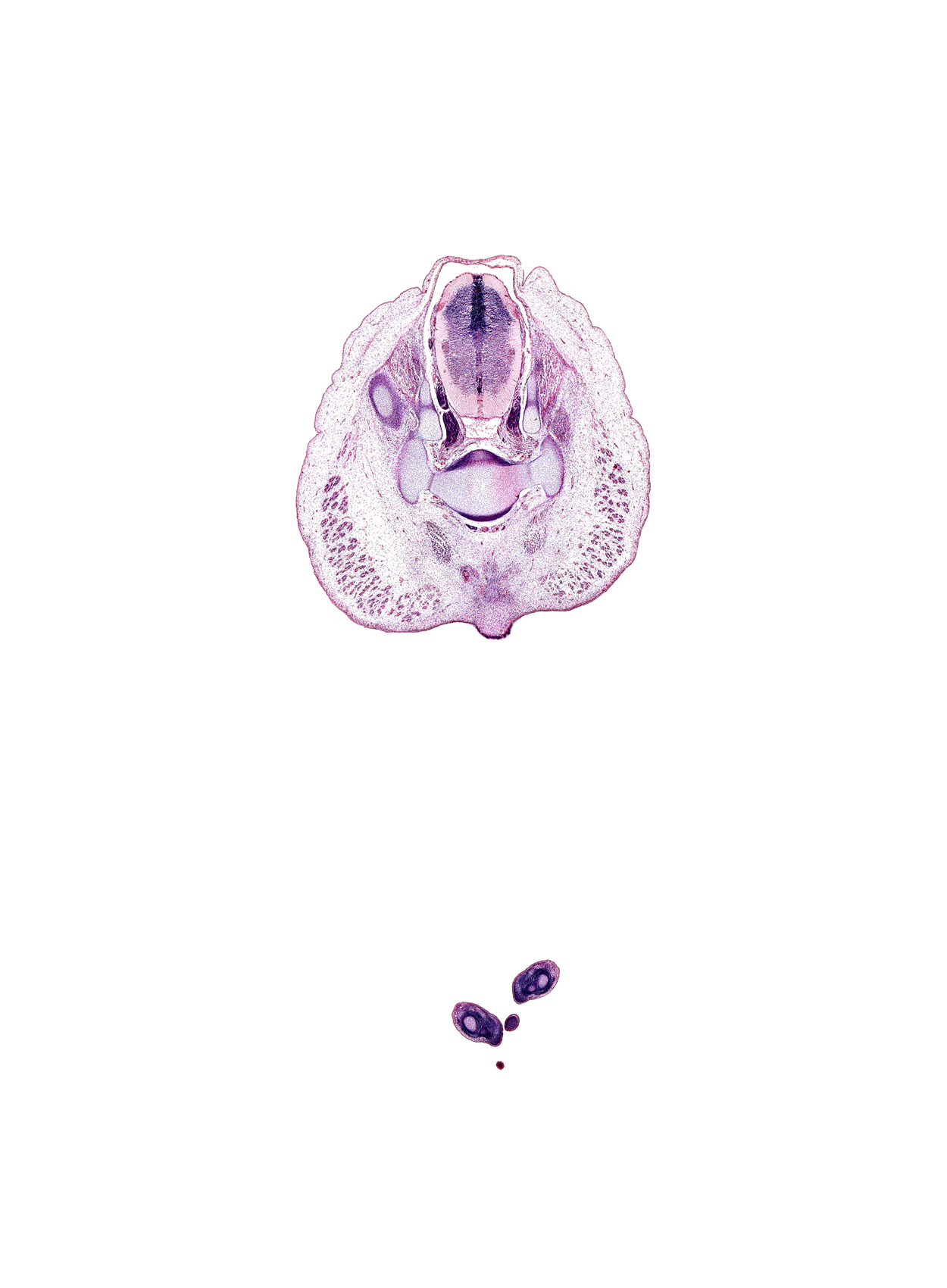 S-2 / S-3 intervertebral region, S-2 spinal ganglion, S-2 spinal nerve, S-3 / S-4 intervertebral region, caudal eminence, centrum of S-3 vertebra, coccygeus muscle, gluteus maximus muscle, sympathetic trunk, thoracolumbar fascia, toe of left foot, toe of right foot