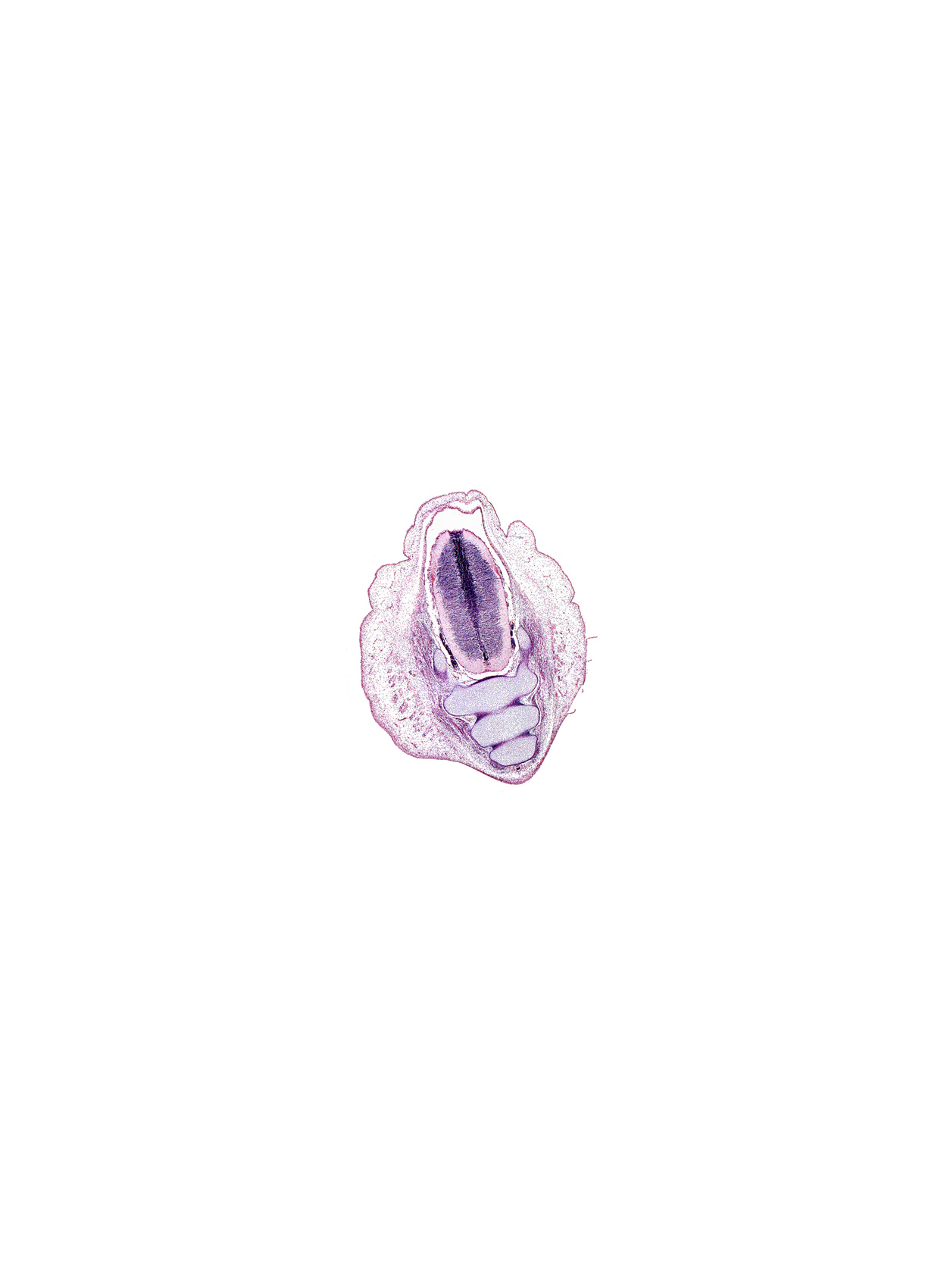 S-3 spinal ganglion, S-5 / Co-1 intervertebral region, caudal eminence, centrum of Co-1 vertebra, centrum of Co-2 vertebra, centrum of S-5 vertebra, dura mater, filum terminale, intermediate zone, loose mesenchyme, marginal zone, neural arch, subarachnoid space, surface ectoderm, ventricular zone