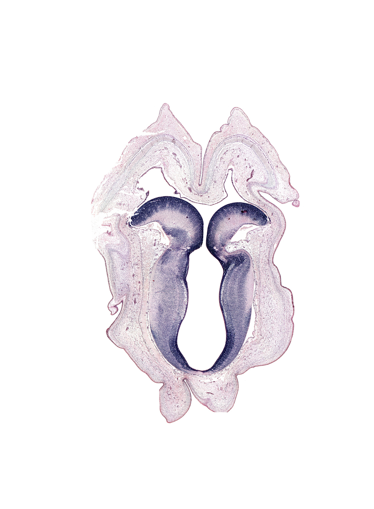 artifact space(s), artifact(s), cerebral aqueduct (mesocoele), commissure of superior colliculus, isthmic canal, isthmic nucleus, rhombencoel (fourth ventricle), subarachnoid space, sulcus limitans, superior colliculus region, trochlear nerve tract